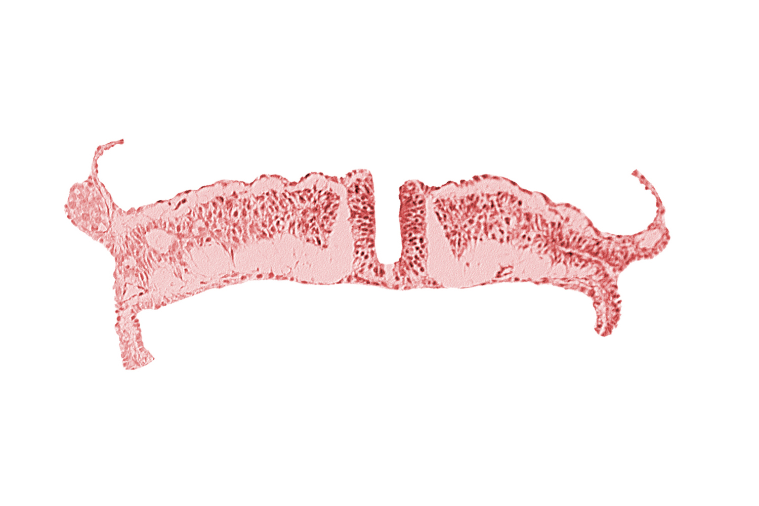 caudal neuropore, dorsal aorta