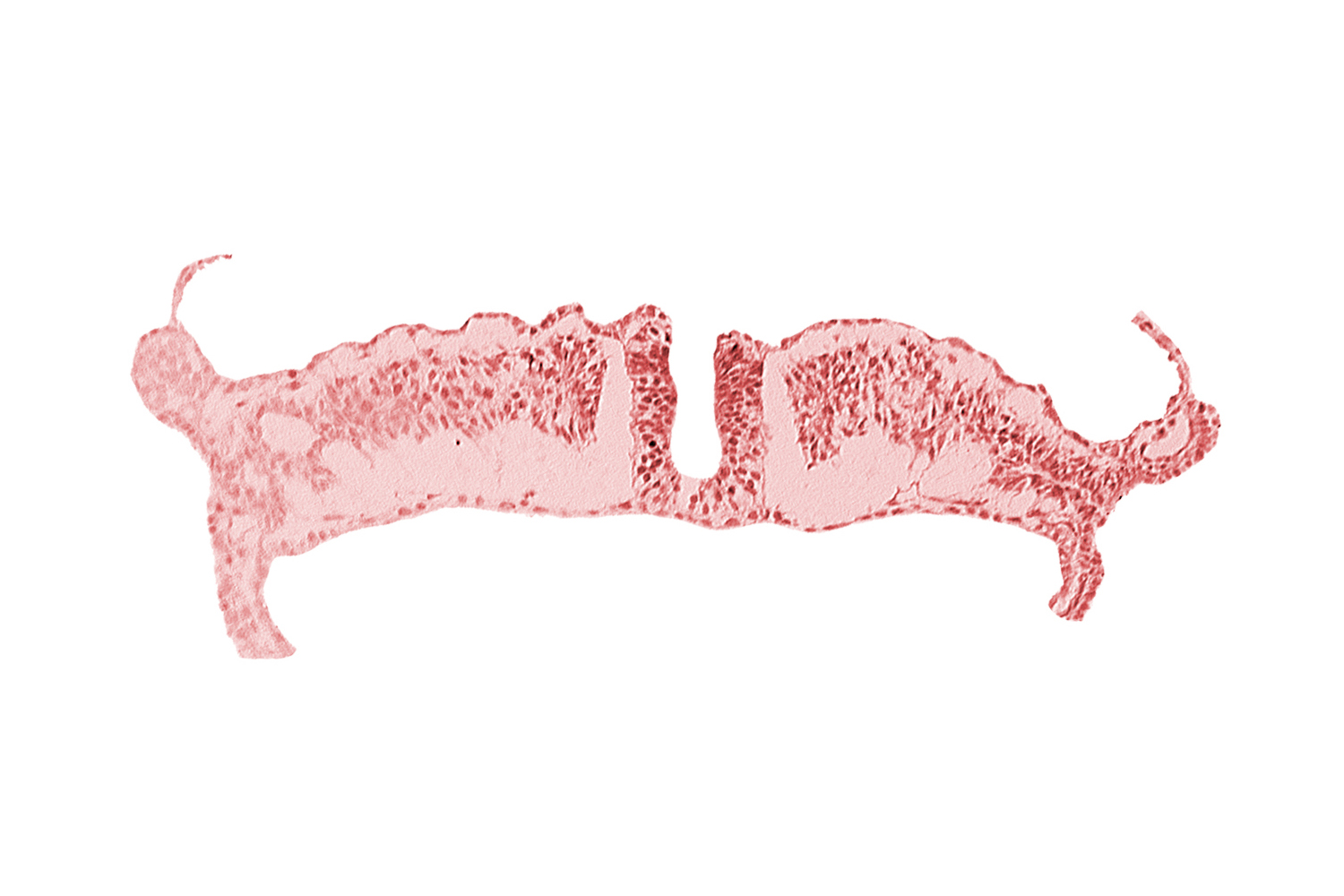 amniotic cavity, caudal neuropore, midgut, umbilical vesicle cavity
