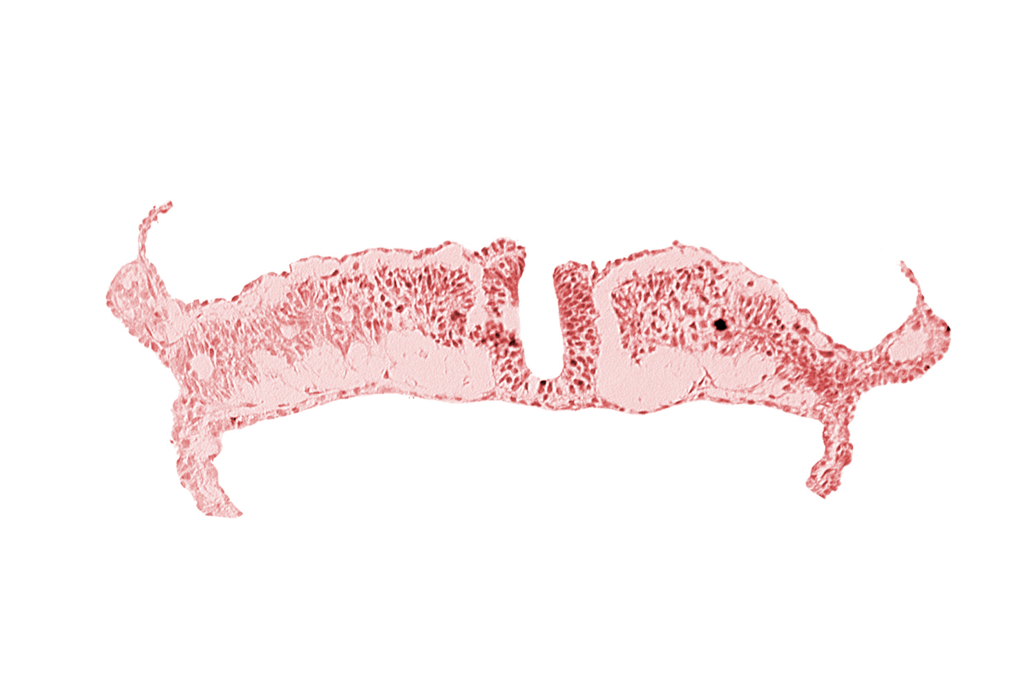 caudal neuropore, endoderm, intermediate mesenchyme, lateral plate mesoderm, paraxial mesoderm, surface ectoderm