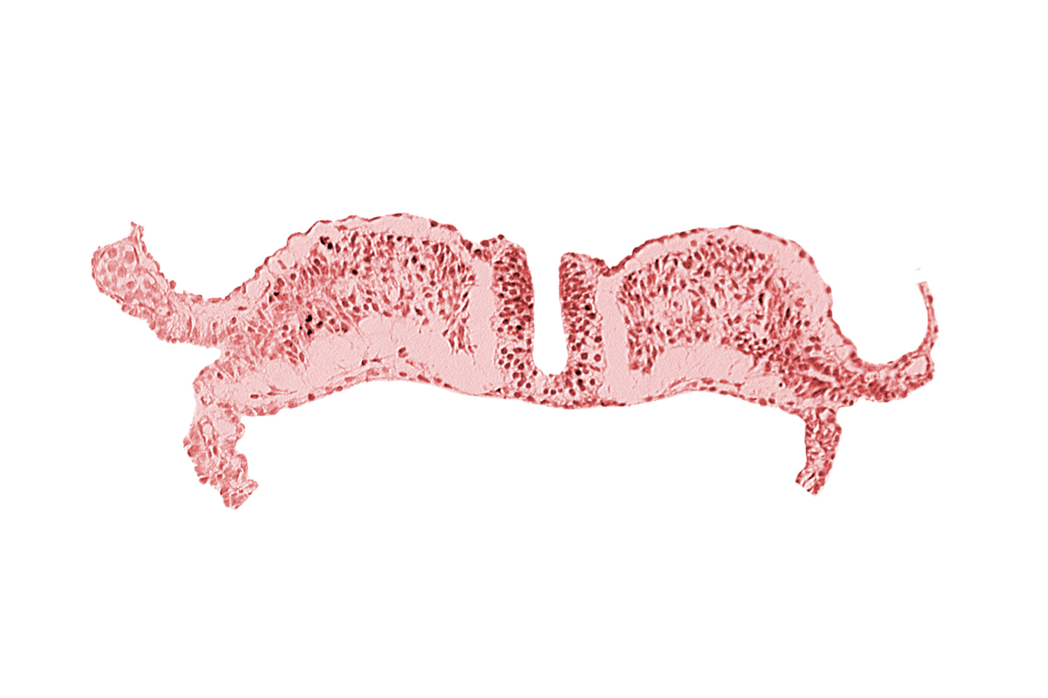 amniotic cavity, caudal neuropore, communication between primordial peritoneal cavity and extra-embryonic coelom, dorsal aorta plexus, umbilical vesicle cavity