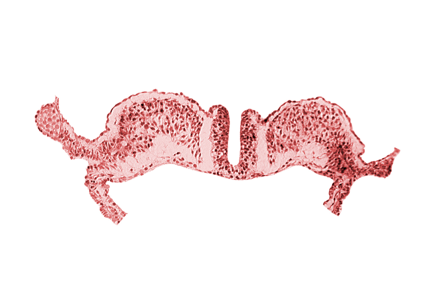 dorsal aorta plexus, notochordal plate, surface ectoderm