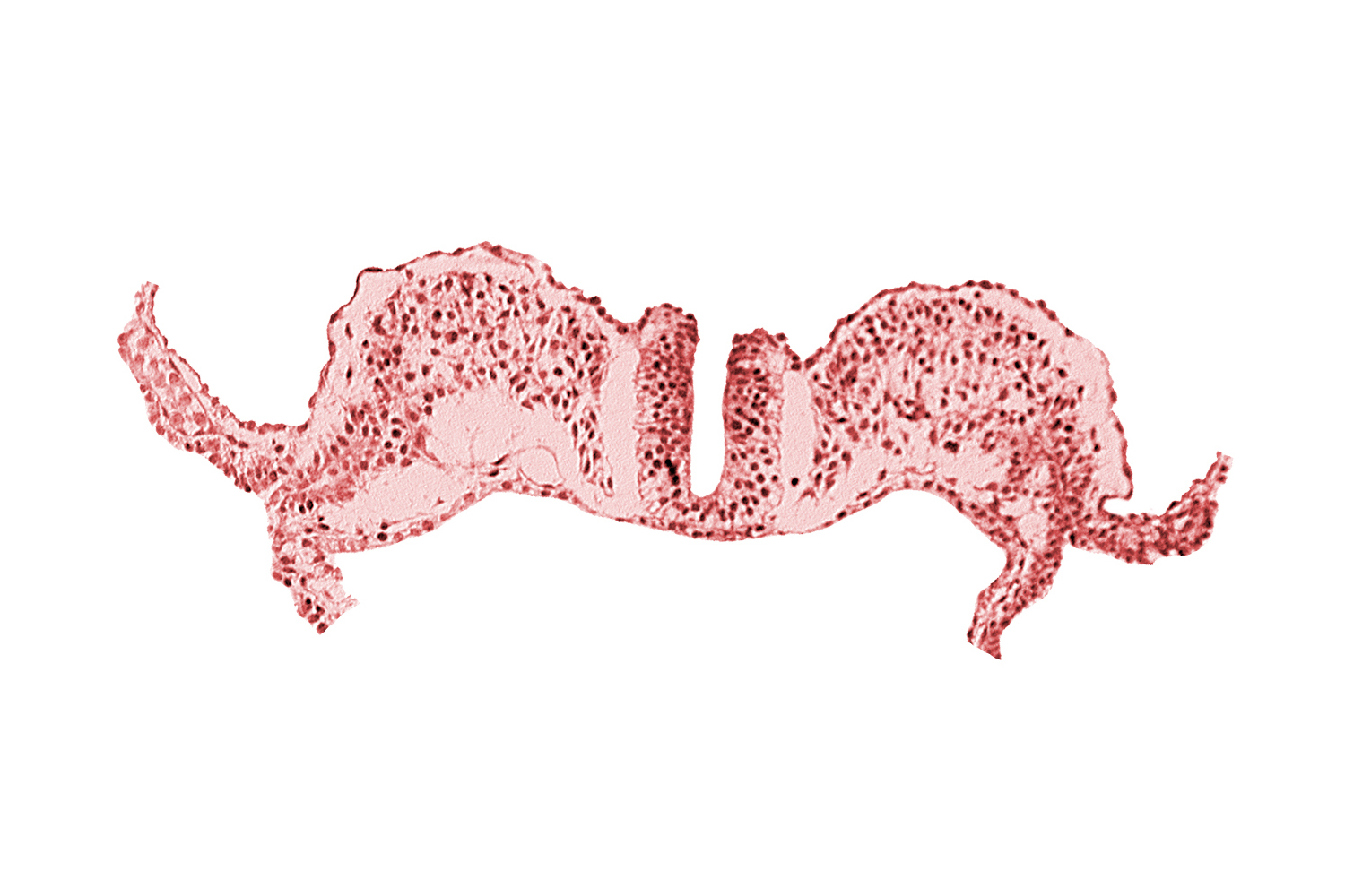 amnion ectoderm, amnion mesoderm, caudal neuropore, dorsal aorta plexus, extra-embryonic coelom, primordial lateral body fold, primordial peritoneal cavity