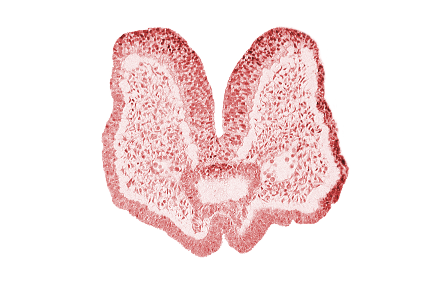 aortic arch 1, artifact space(s), cephalic neuropore, cephalic part of foregut, mandibular prominence of pharyngeal arch 1, mesencephalic neural crest, neural fold [mesencephalon (M)], neural groove (postoptic recess), notochordal plate, prechordal plate (oropharyngeal membrane), region of mesencephalic (cephalic) flexure, stomodeum, surface ectoderm