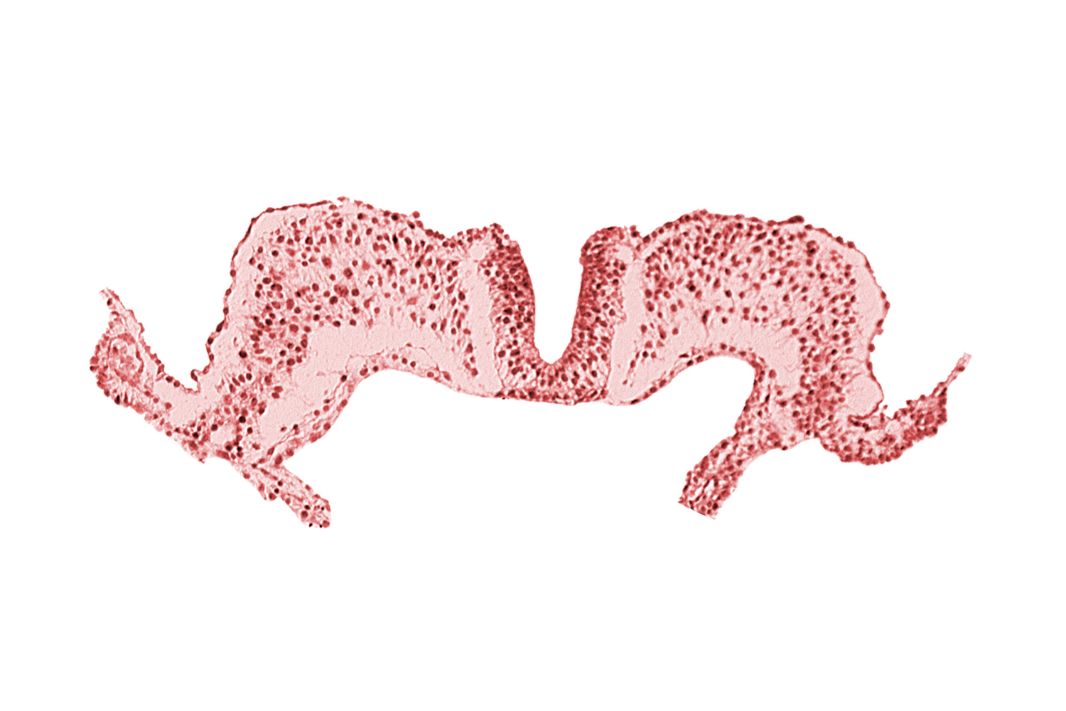 amnion attachment, amniotic cavity, caudal neuropore, primordial lateral body fold