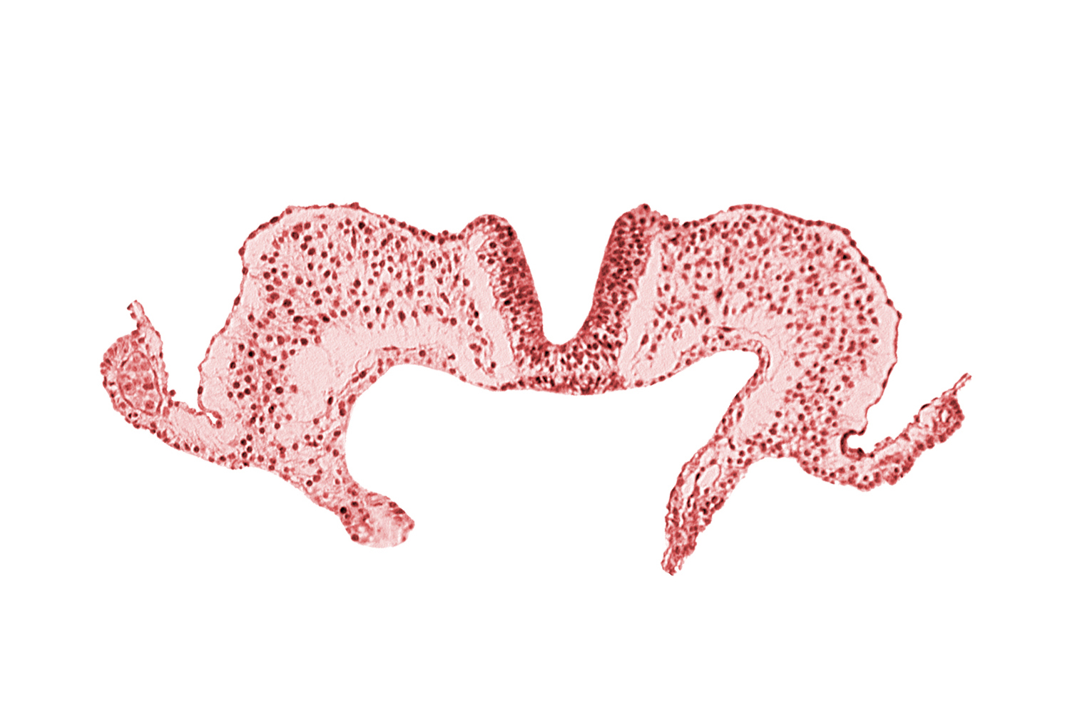 amniotic cavity, caudal neuropore, midgut, primordial lateral body fold