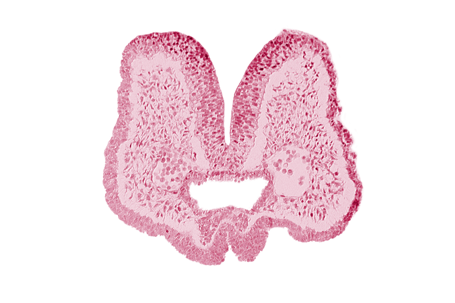 aortic arch 1, artifact space(s), endoderm, foregut, mandibular prominence of pharyngeal arch 1, mesencephalic neural crest, mesenchyme in pharyngeal arch 1, neural fold [mesencephalon (M)], neural groove, notochordal plate, prechordal plate (oropharyngeal membrane), stomodeum, surface ectoderm