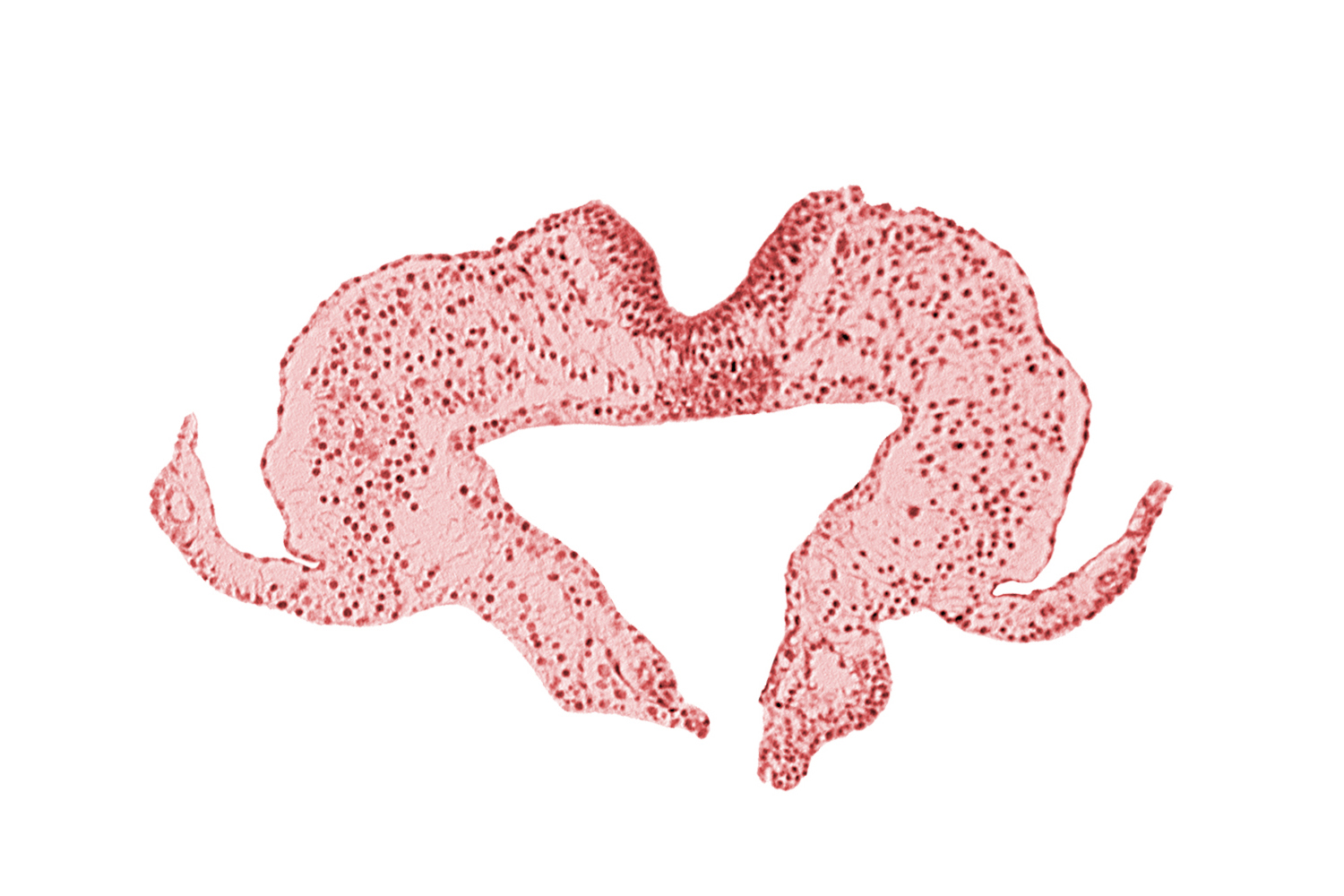 mesoderm, midgut, neural fold, neural groove, primordial lateral body fold, surface ectoderm