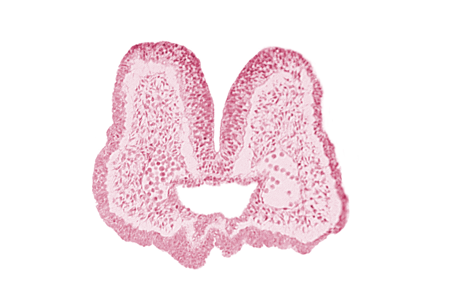 aortic arch 1, artifact space(s), endoderm, foregut, mandibular prominence of pharyngeal arch 1, mesencephalic neural crest, mesenchyme in pharyngeal arch 1, neural fold [mesencephalon (M)], neural groove, nucleated blood cells, prechordal plate (oropharyngeal membrane), stomodeum, surface ectoderm
