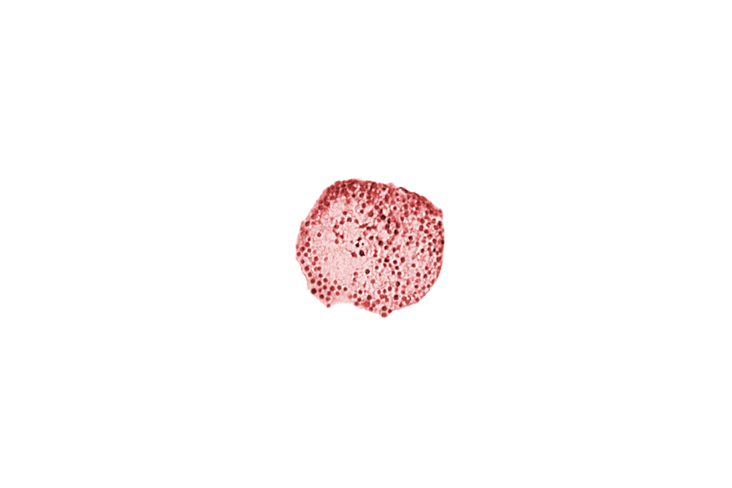 caudal part of caudal eminence