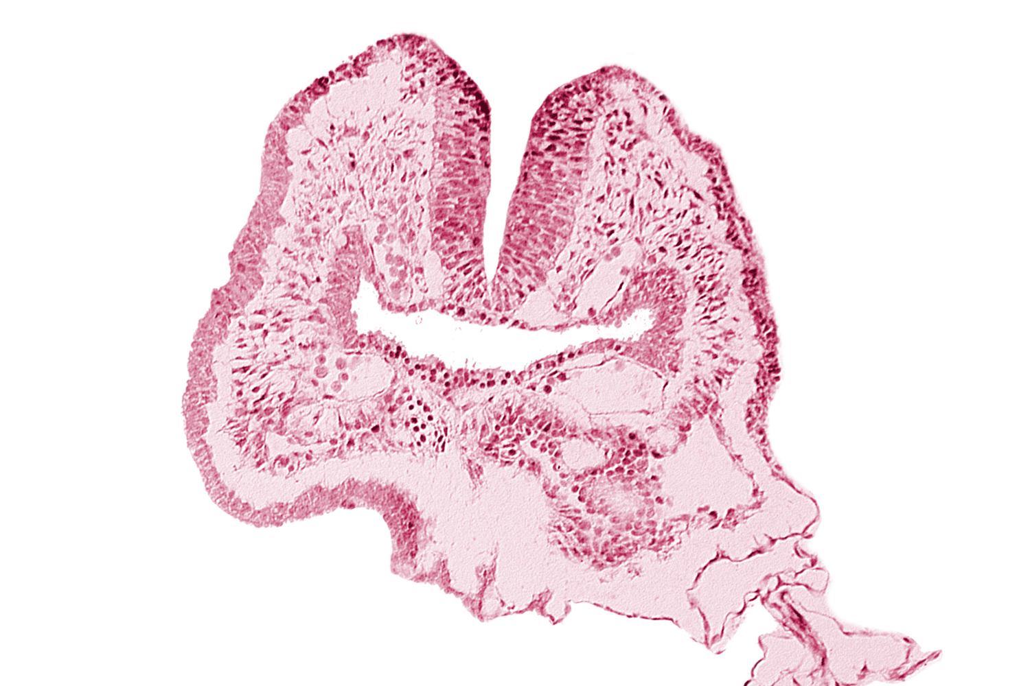amnion, amnion attachment, aortic arch 1, cephalic neuropore, dorsal aorta, endoderm, facio-vestibulocochlear neural crest (CN VII and CN VIII), floor of foregut, head fold region, neural fold [rhombencephalon (Rh. A)], pericardial cavity, pharyngeal pouch 1, surface ectoderm