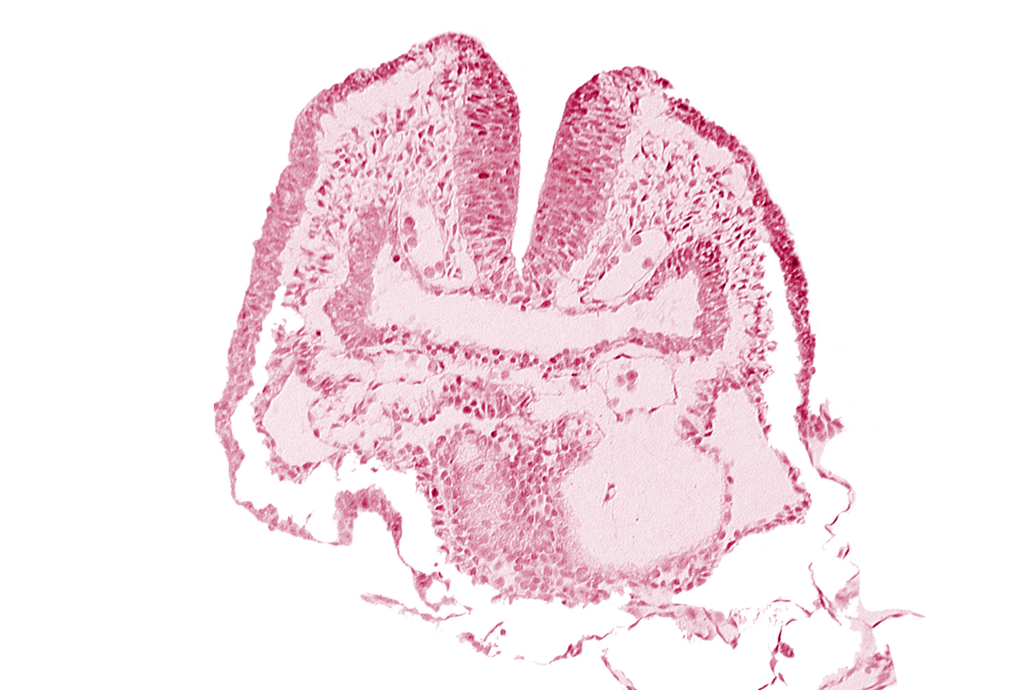 amnion, aortic arch 1, cephalic neuropore, dorsal aorta, facio-vestibulocochlear neural crest (CN VII and CN VIII), head fold region, neural fold [rhombencephalon (Rh. A)], pericardial cavity, pharyngeal pouch 1, pharyngeal pouch 1 endoderm: dorsal part, pharyngeal pouch 1 endoderm: ventral part