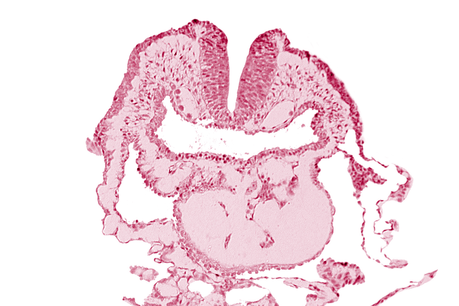 amnion, aortic arch 1, cephalic neuropore, conotruncus, dorsal aorta, head mesenchyme, neural fold [rhombencephalon (Rh. A)], pericardial cavity, pharyngeal pouch 1, pharyngeal pouch 1 endoderm: dorsal part, pharyngeal pouch 1 endoderm: ventral part