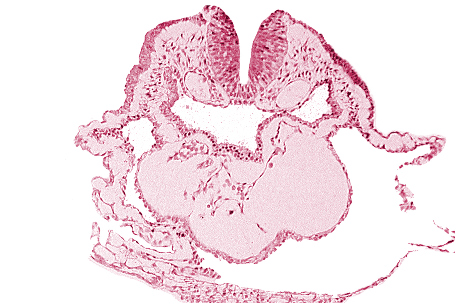 aortic arch 1, cardiac jelly, conotruncus, dorsal aorta, epimyocardium, lateral pharyngeal recess, left bulboventricular sulcus, neural fold [rhombencephalon (Rh. A)], pericardial cavity, thyroid gland primordium