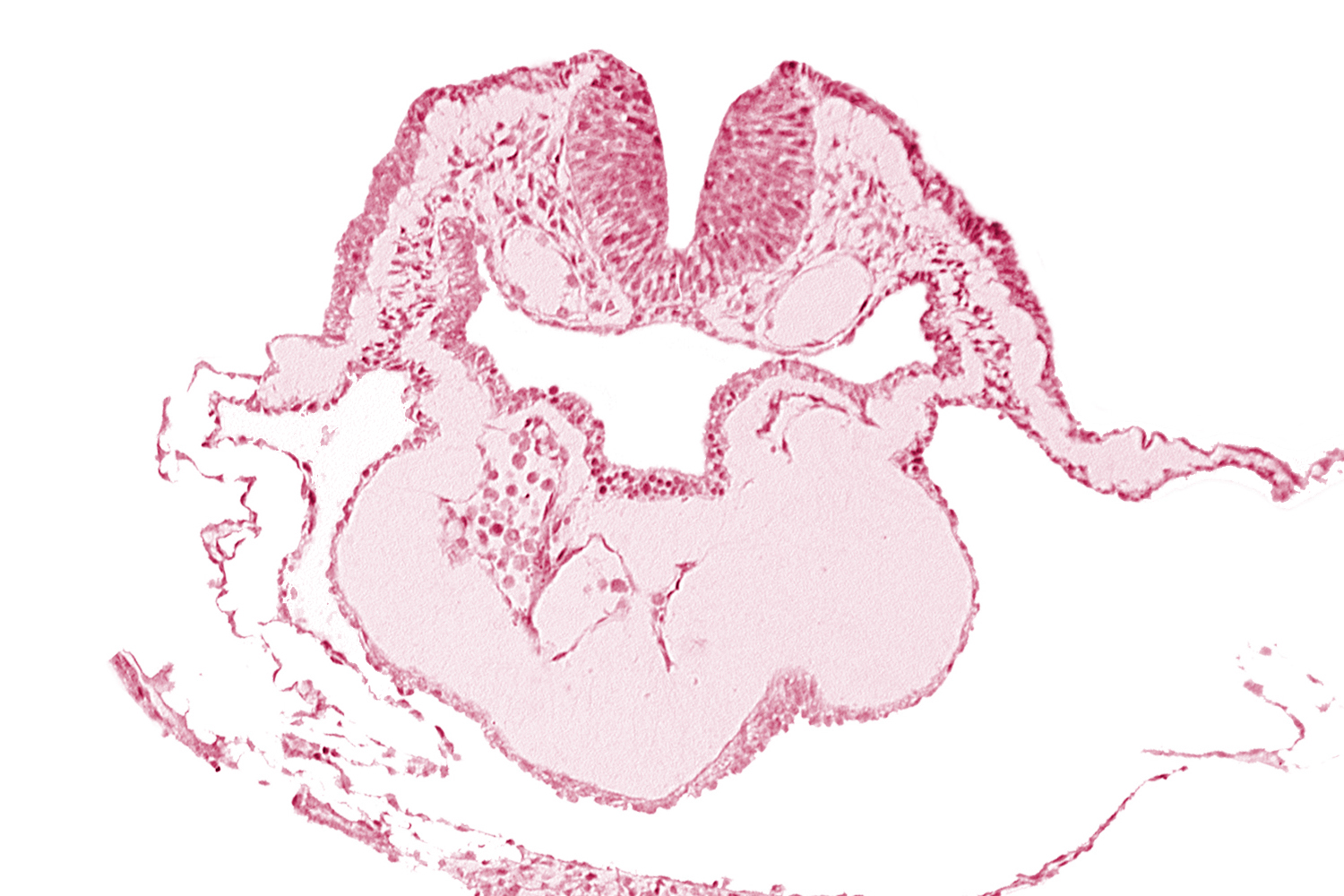 artifact separation(s), bulbis cordis, caudal edge of aortic arch 1, dorsal aorta, epimyocardium, lateral pharyngeal recess, left bulboventricular sulcus, looped heart, neural fold [rhombencephalon (Rh. B)], notochordal plate