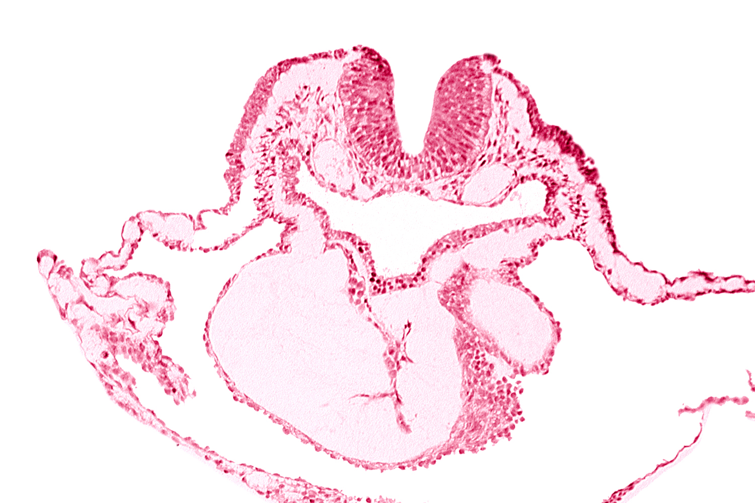 artifact separation(s), bulbis cordis, dorsal aorta, lateral pharyngeal recess, left bulboventricular sulcus, neural fold [rhombencephalon (Rh. B)], notochordal plate, pericardial cavity, presumptive left ventricle, presumptive right ventricle