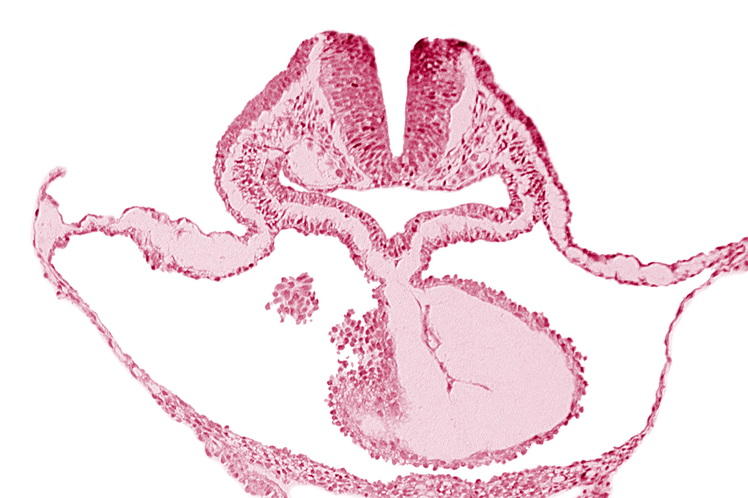 cephalic neuropore, epimyocardium, laryngotracheal sulcus, lateral pharyngeal recess, looped heart, mesocardium, neural fold [rhombencephalon (Rh. B)], notochordal plate, otic placode, pericardial cavity, pericardial sac, presumptive left ventricle