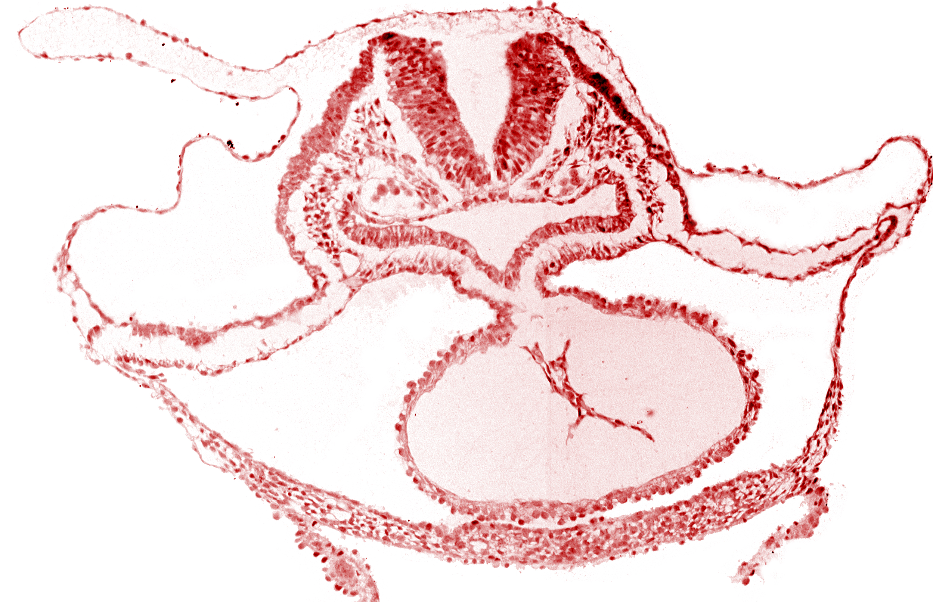 alar plate(s), basal plate, cardiac jelly, dorsal aorta, epimyocardium, laryngotracheal sulcus, neural fold [rhombencephalon (Rh. B)], otic placode, pericardial cavity, presumptive left ventricle, sulcus limitans