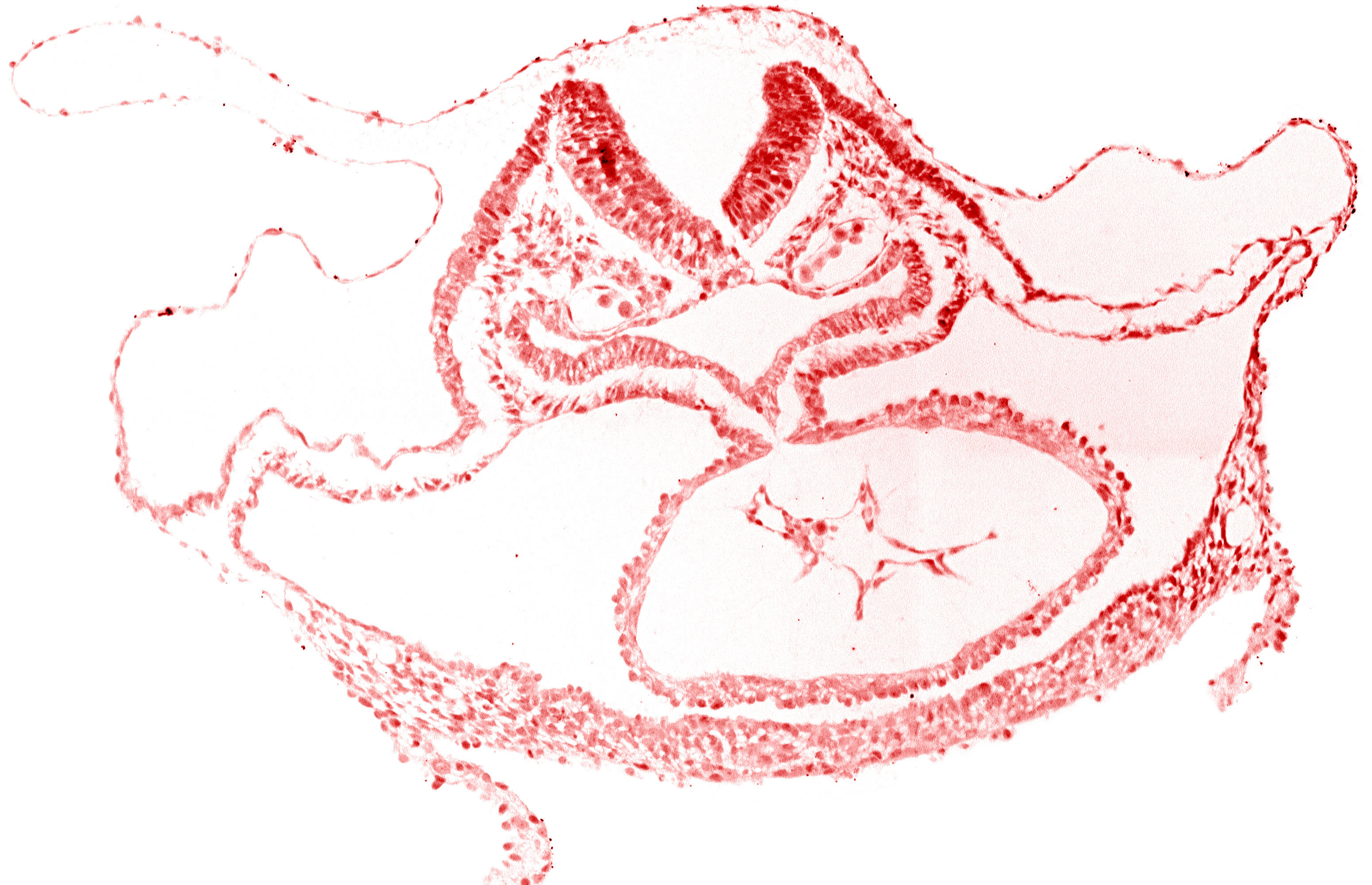 artifact separation(s), cardiac jelly, cephalic neuropore, dorsal aorta, foregut endoderm, foregut lumen, laryngotracheal sulcus, otic placode, presumptive left ventricle, respiratory primordium