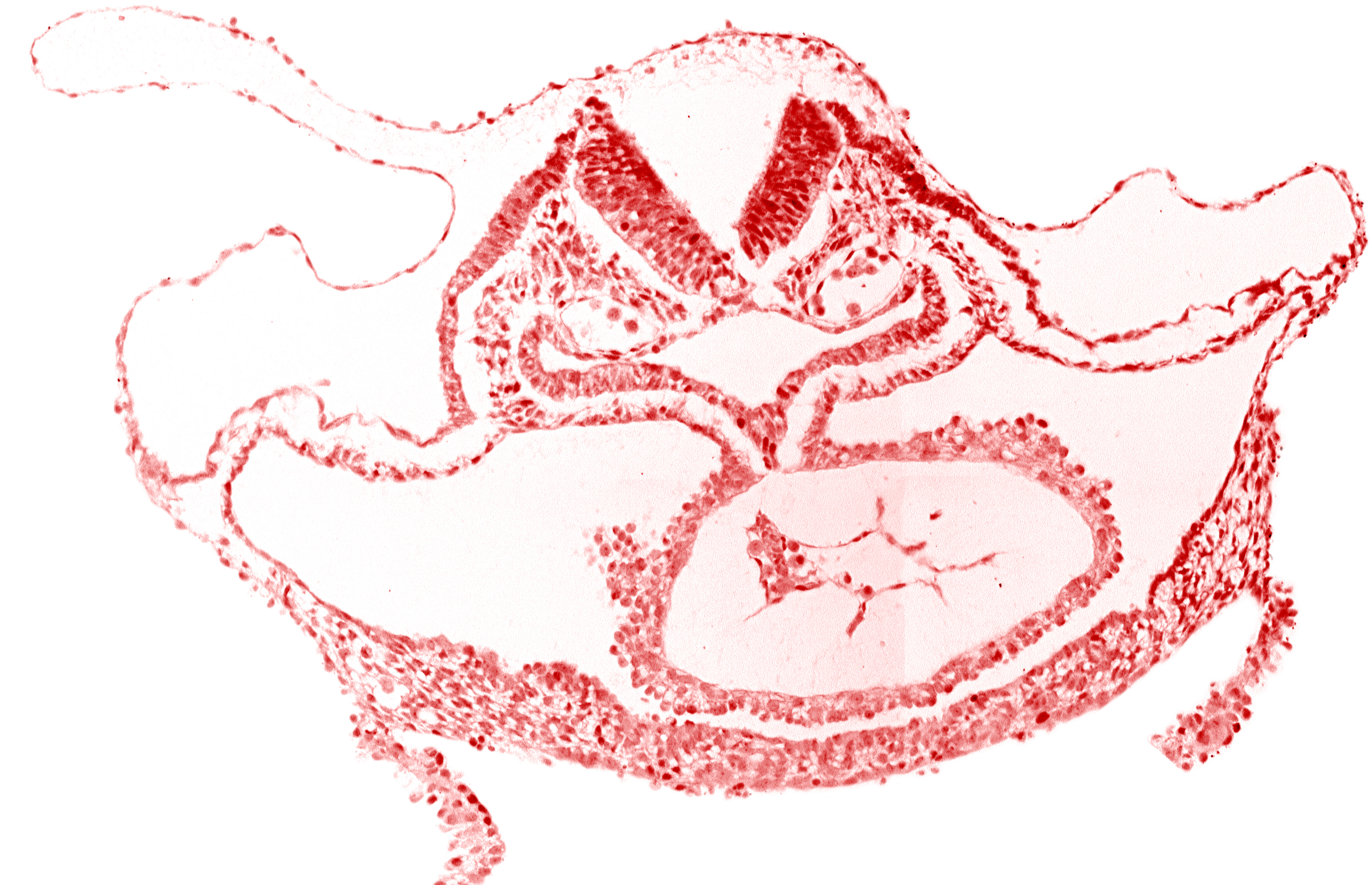 artifact separation(s), cardiac jelly, cephalic neuropore, dorsal aorta, foregut lumen, laryngotracheal sulcus, mesocardium, neural fold [rhombencephalon (Rh. C)], otic placode, presumptive left ventricle, primordial atrioventricular junction, respiratory primordium