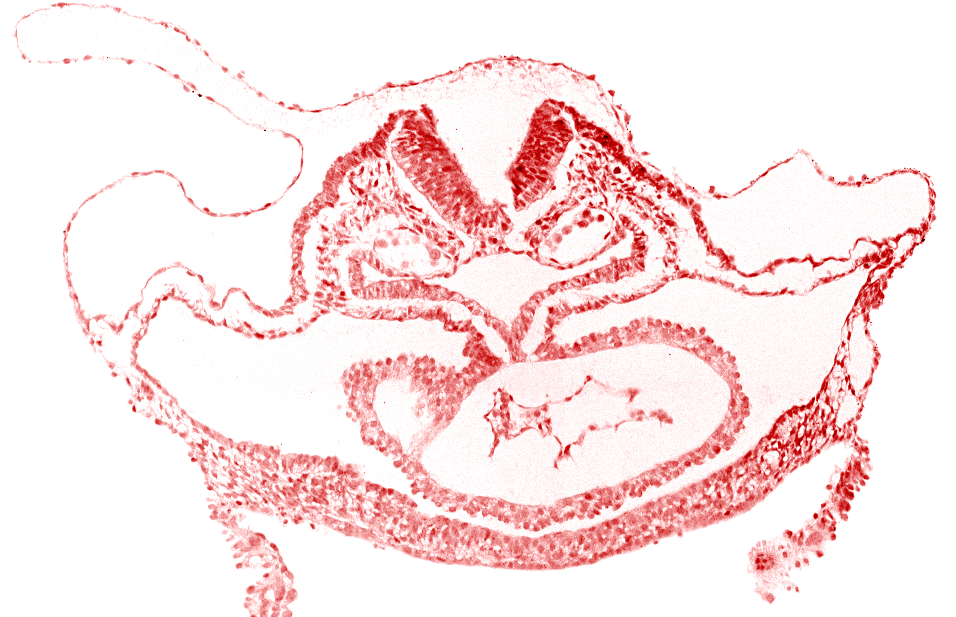 artifact separation(s), atrial canal, cephalic neuropore, dorsal aorta, foregut endoderm, foregut lumen, otic placode, presumptive left ventricle