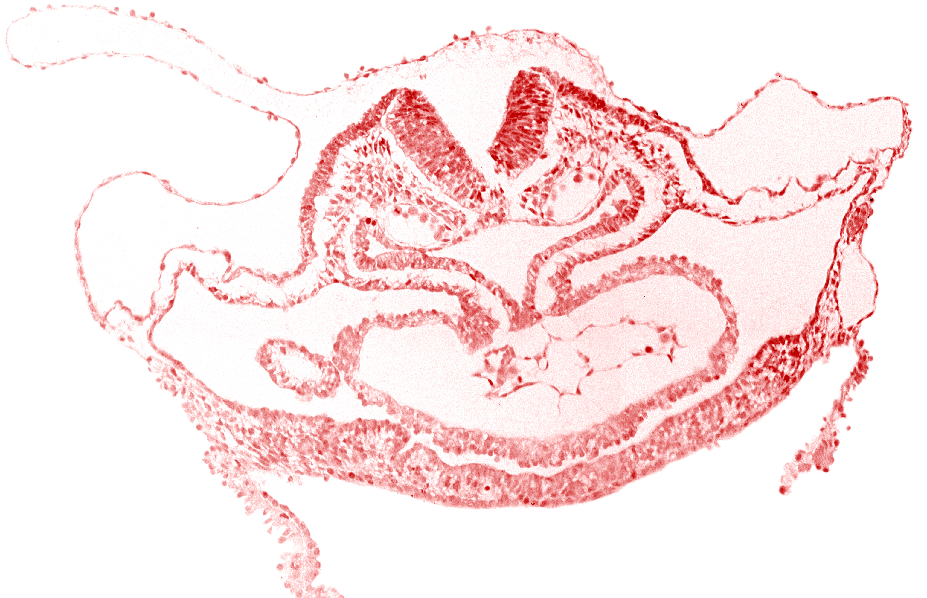artifact separation(s), atrial canal, cardiac jelly, cephalic edge of hepatic plate, cephalic neuropore, dorsal aorta, otic placode, pericardial cavity, presumptive left ventricle, presumptive right atrium, primordial atrioventricular junction