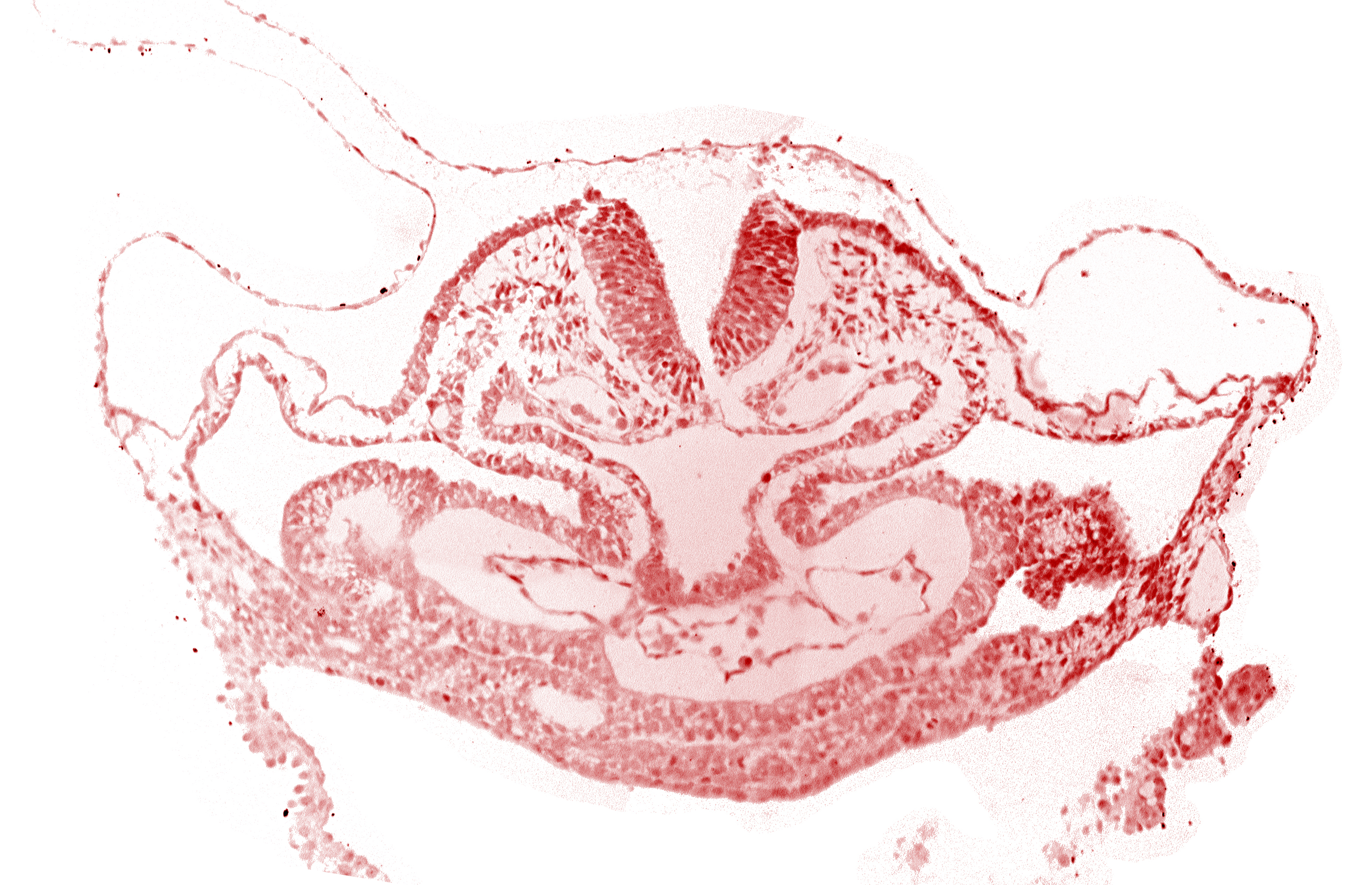 amnion attachment, atrial canal, caudal edge of otic placode, dorsal aorta, hepatic plate, neural fold [rhombencephalon (Rh. C)], presumptive left atrium, presumptive right atrium