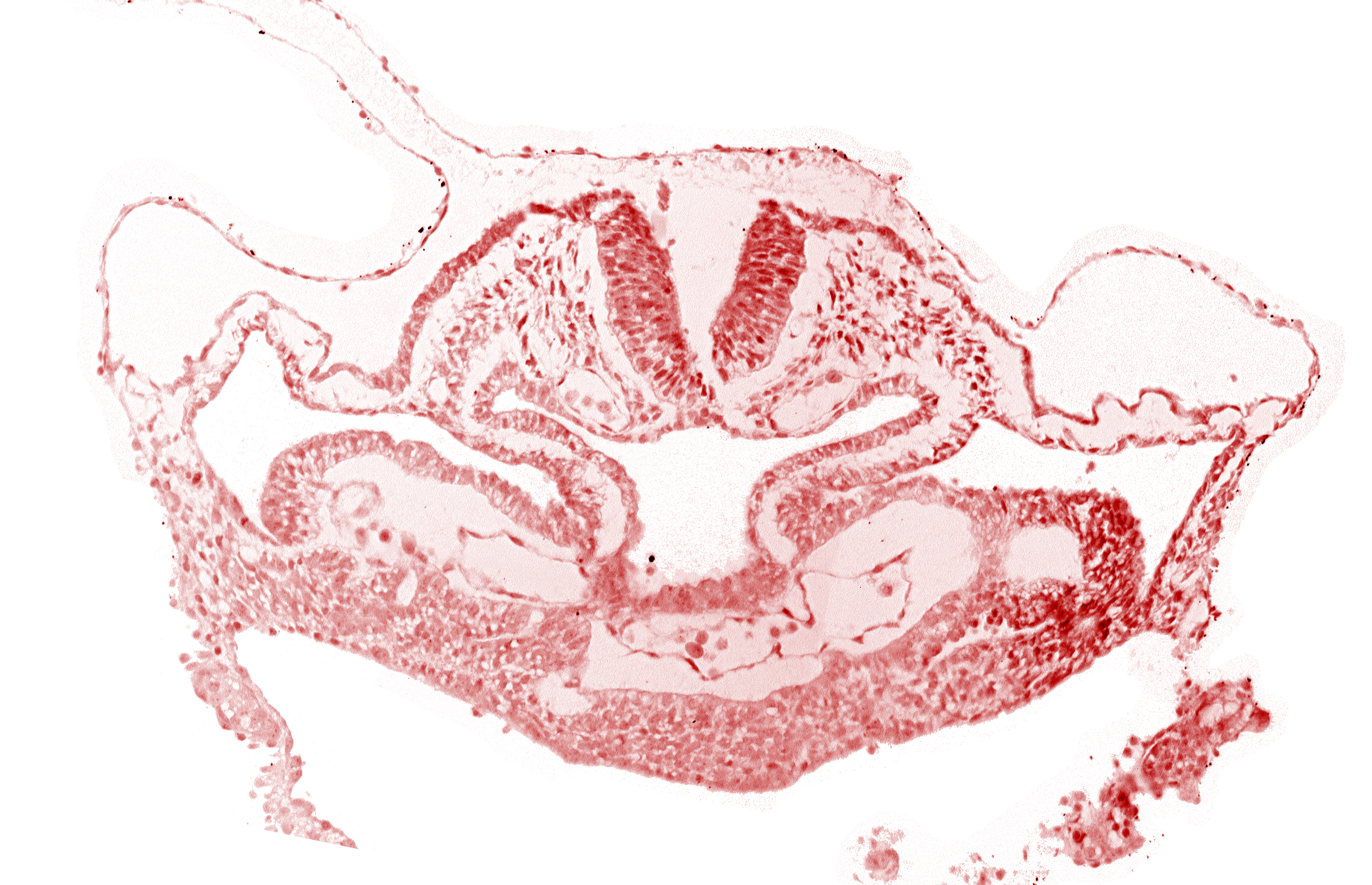 amnion attachment, atrial canal, cephalic neuropore, foregut, hepatic plate, neural fold [rhombencephalon (Rh. C)], presumptive left atrium, presumptive right atrium, primordial pericardioperitoneal canal (pleural cavity), septum transversum, surface ectoderm