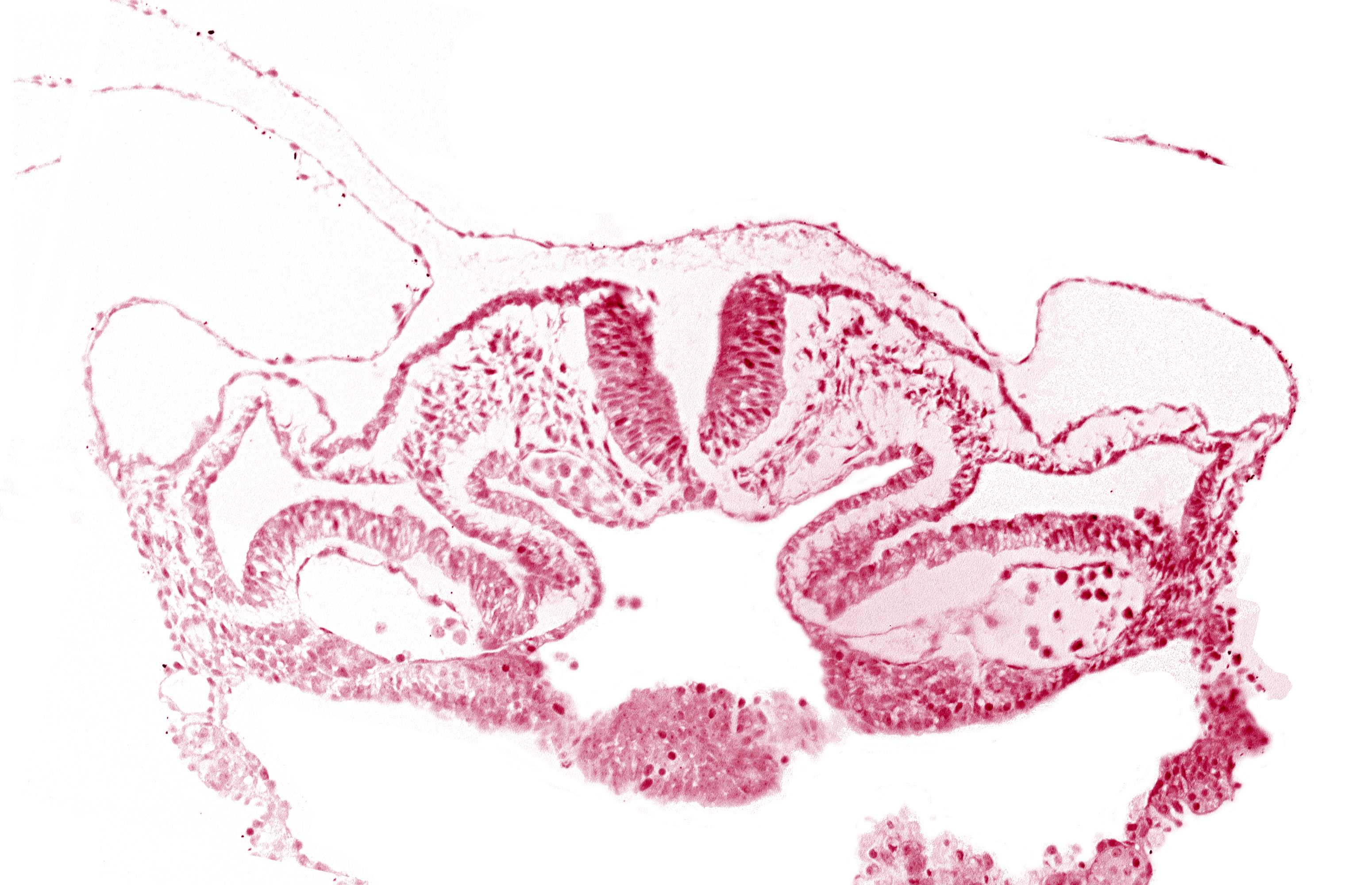alar plate(s), basal plate, cephalic intestinal portal, dorsal aorta, head mesenchyme, hepatic plate / septum transversum region, neural fold [rhombencephalon (Rh. C)], notochordal plate, presumptive left atrium, presumptive right atrium, primordial pericardioperitoneal canal (pleural cavity), sulcus limitans