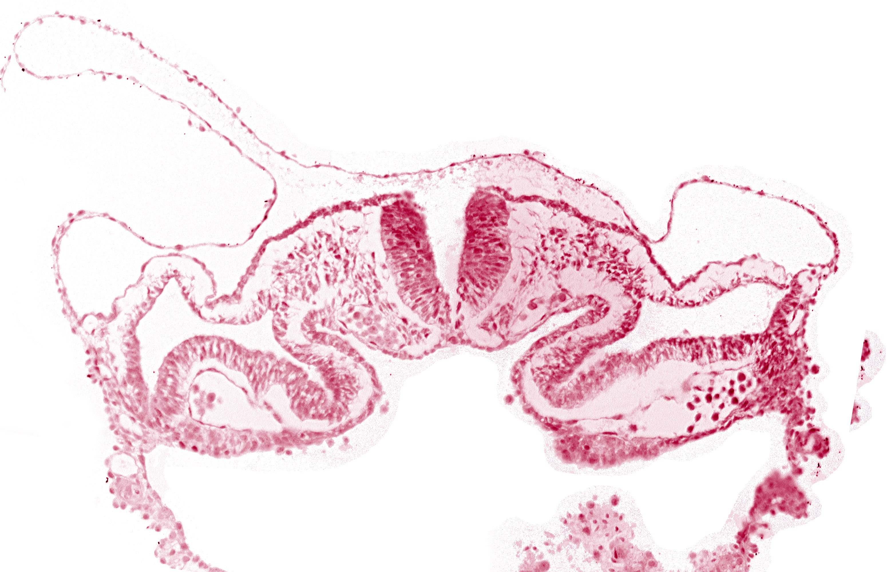 amnion attachment, amniotic cavity, artifact separation(s), midgut, presumptive right atrium, primordial pericardioperitoneal canal (pleural cavity), surface ectoderm, umbilical vesicle cavity