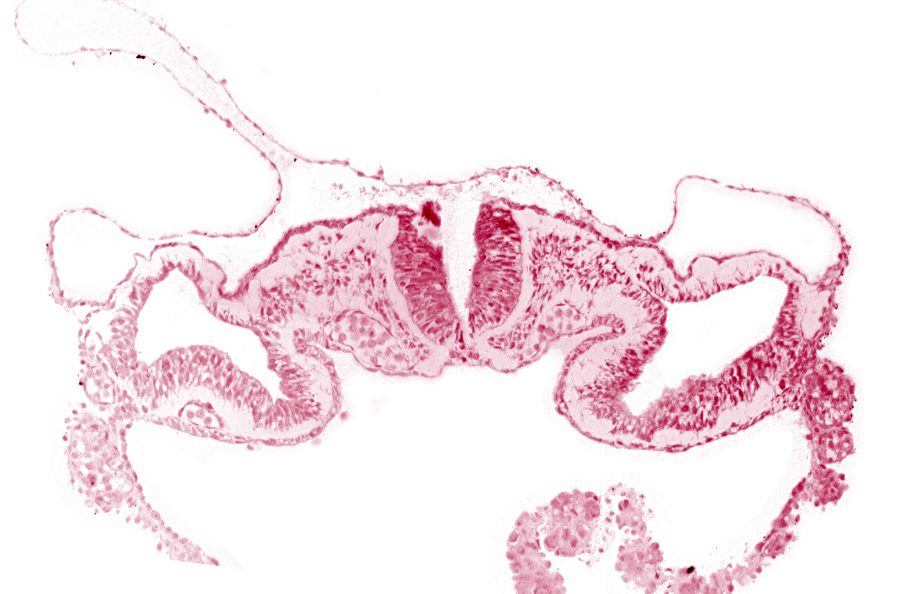 artifact separation(s), dorsal aorta, intermediate mesenchyme, midgut, neural fold [rhombencephalon (Rh. C)], paraxial mesoderm, presumptive right atrium, primordial peritoneal cavity, somatopleure, surface ectoderm, umbilical vesicle cavity