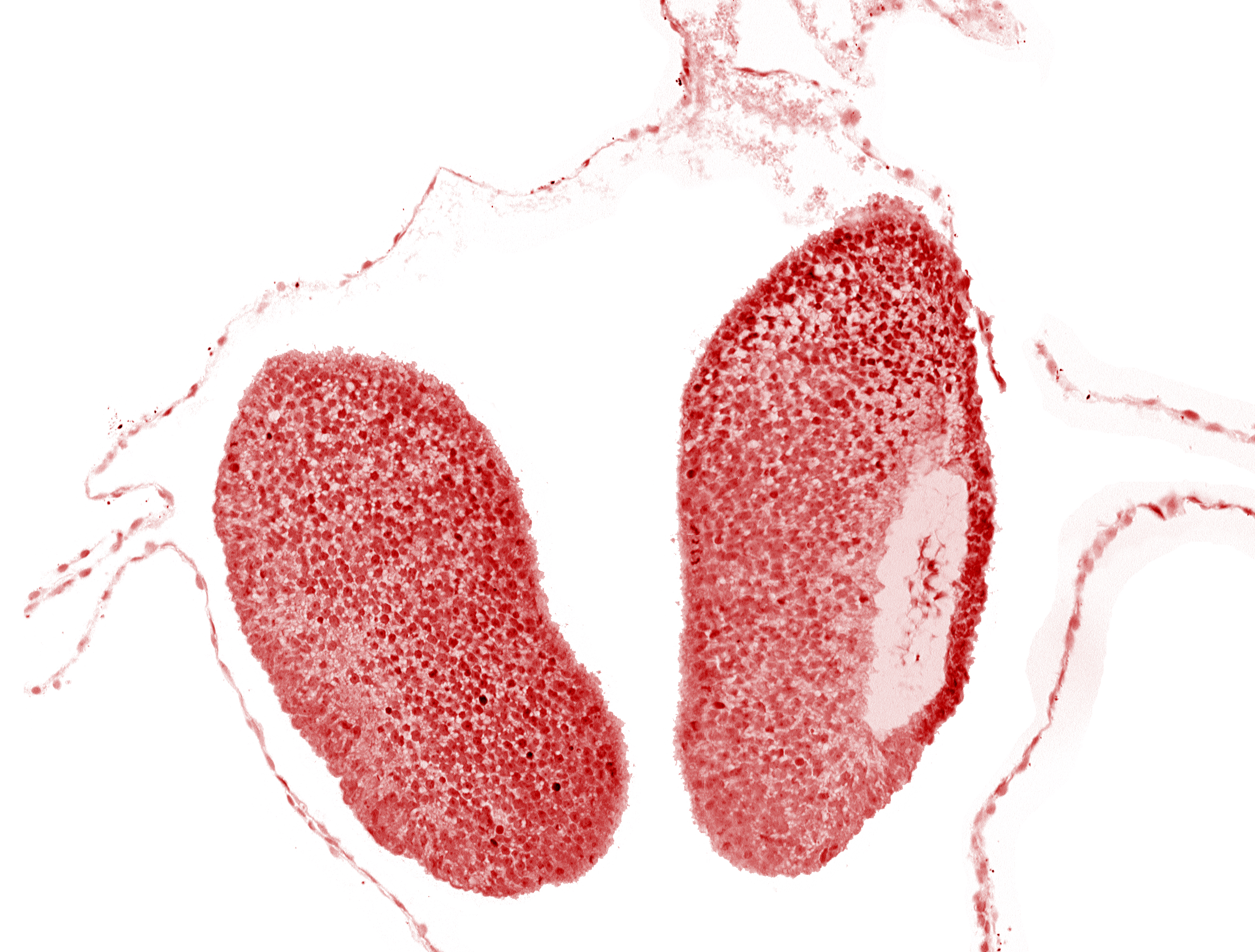 artifact space(s), head mesenchyme, neural fold [primordial diencephalon (D1)], neural fold [primordial diencephalon (D2)]