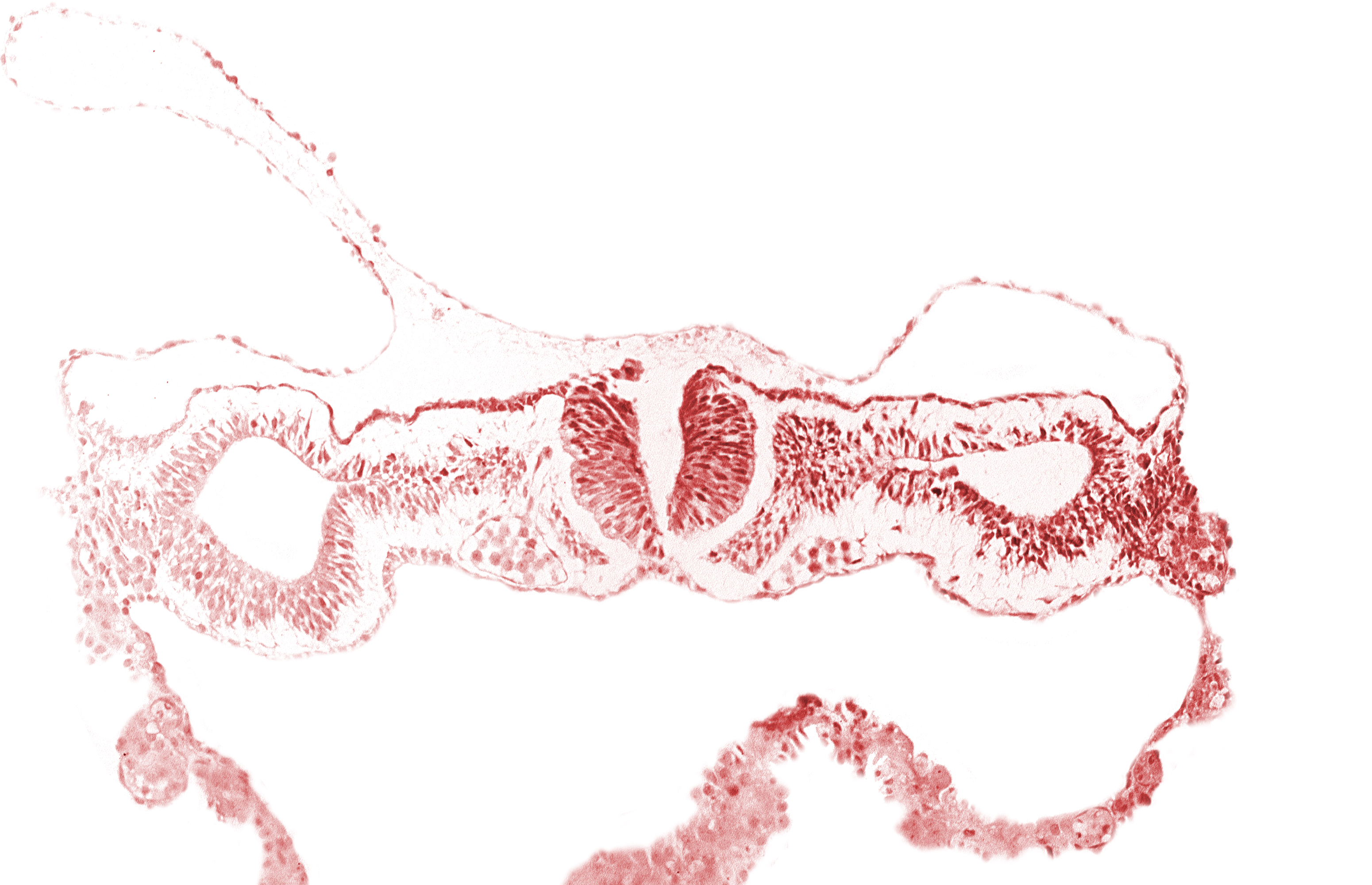 cephalic neuropore, dorsal aorta, intermediate mesenchyme, notochordal plate, primordial peritoneal cavity, sclerotomal cells, somatopleuric mesoderm, somite 1 (O-1), splanchnopleuric mesoderm
