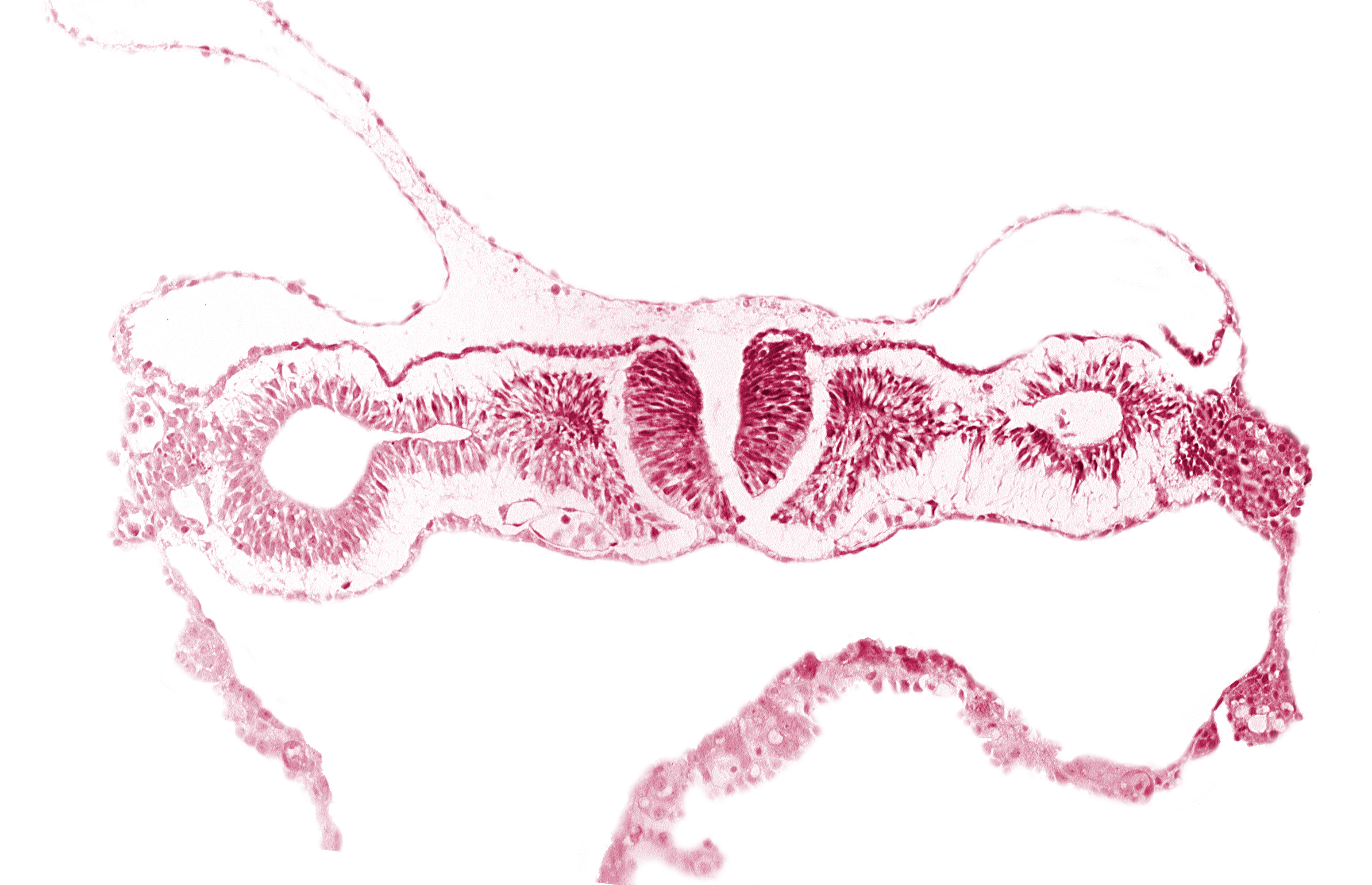 artifact separation(s), dorsal aorta, midgut, neural fold [rhombencephalon (Rh. D)], primordial peritoneal cavity, somite 1 (O-1)