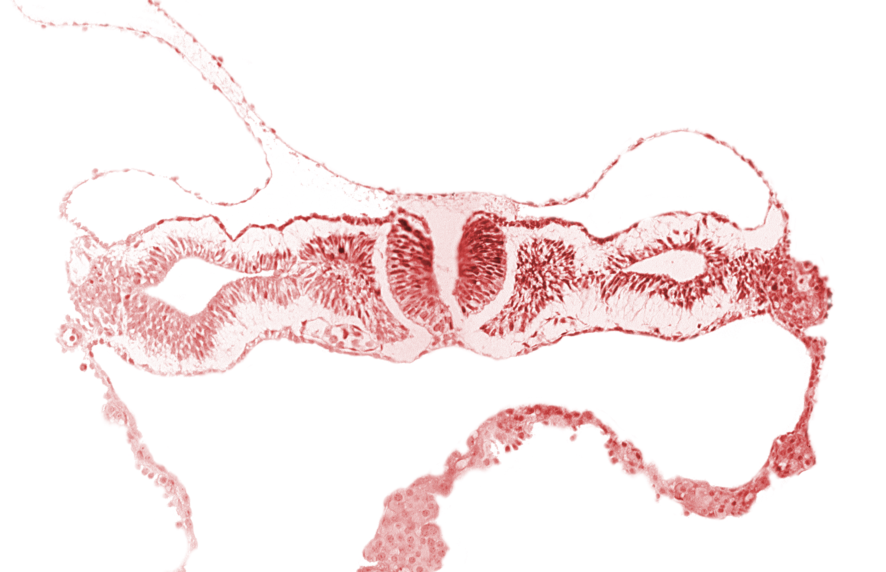 artifact separation(s), cephalic neuropore, dorsal aorta, primordial peritoneal cavity, somite 1 (O-1)