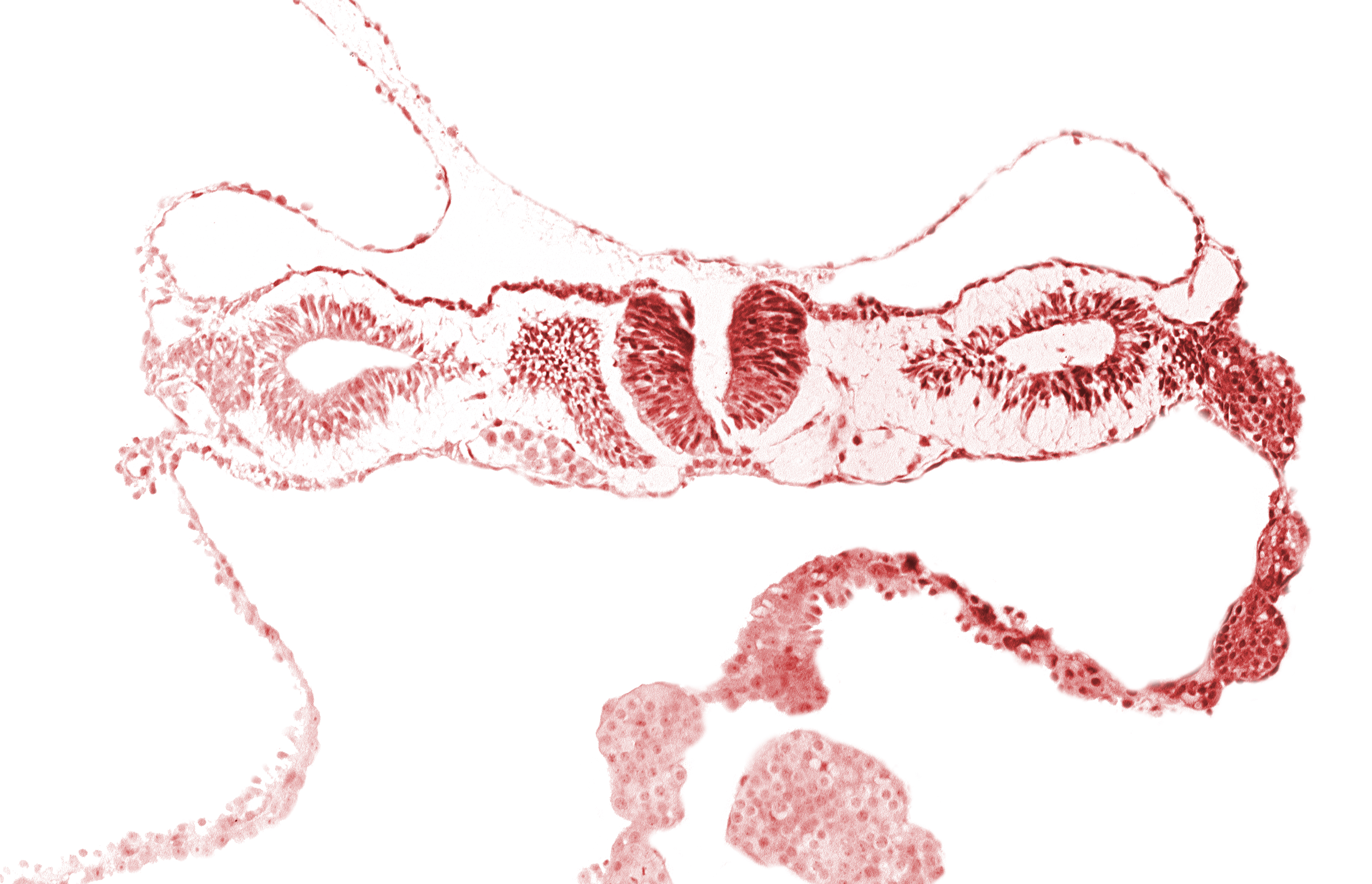 artifact separation(s), dorsal aorta, neural fold [rhombencephalon (Rh. D)], primordial peritoneal cavity, right umbilical vein, somite 1-2 intersegmental region