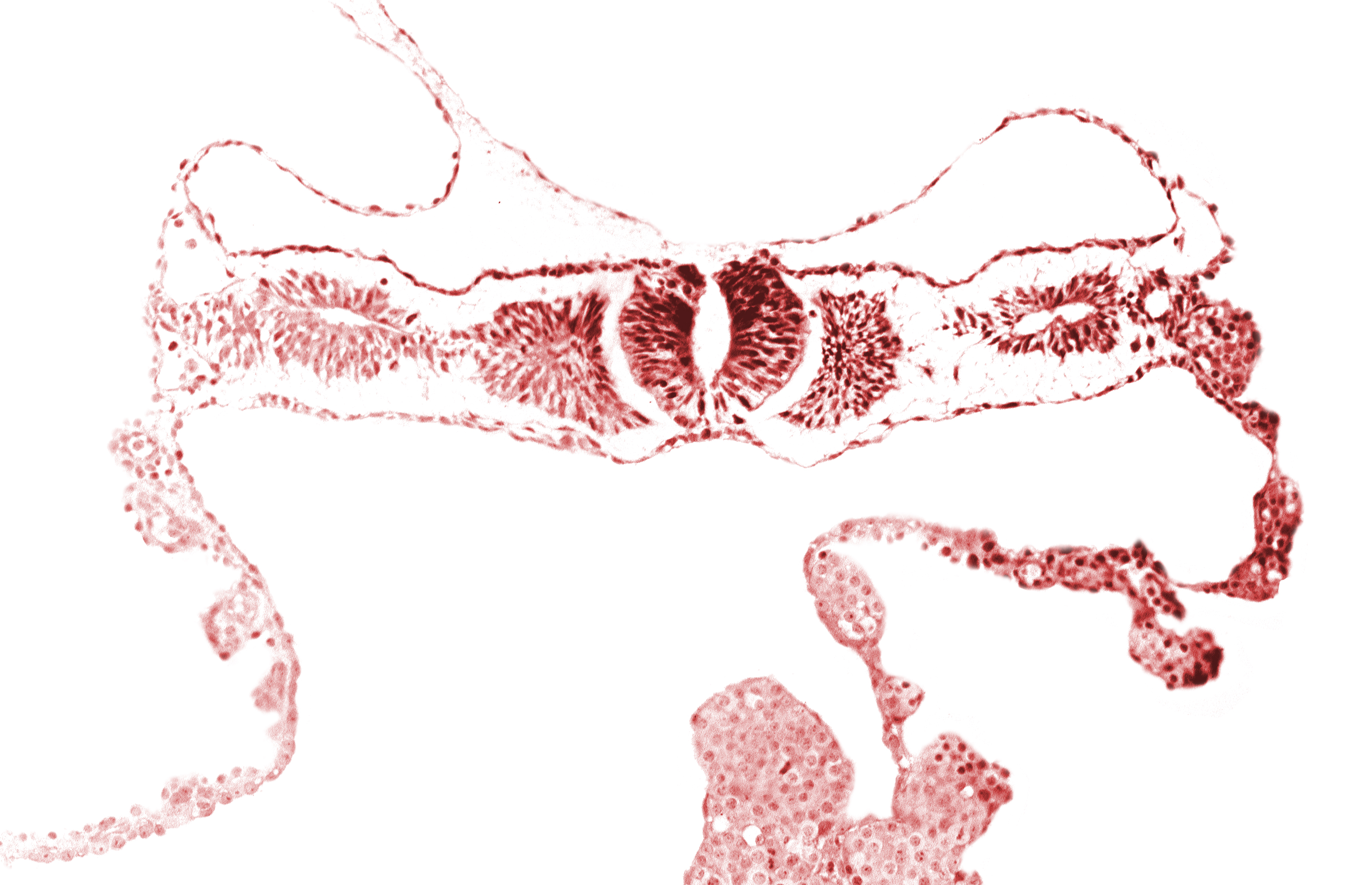 amnion, caudal edge of cephalic neuropore, neural fold [rhombencephalon (Rh. D)], notochordal plate, primordial peritoneal cavity, right umbilical vein, somite 2 (O-2), umbilical vesicle wall