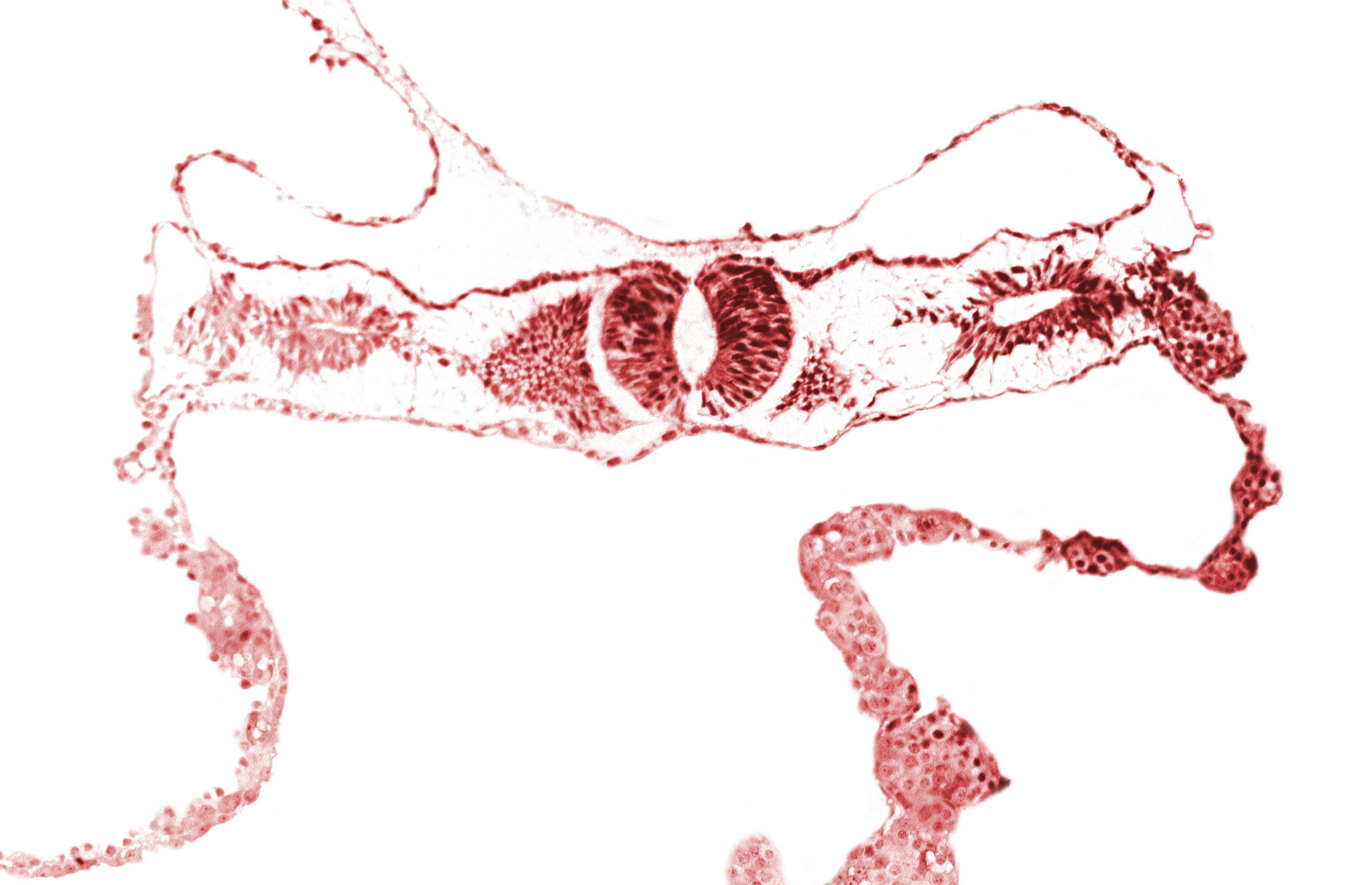 amnion, junction area of neural folds [rhombencephalon (Rh. D)], midgut, notochordal plate, primordial peritoneal cavity, somite 2-3 intersegmental region