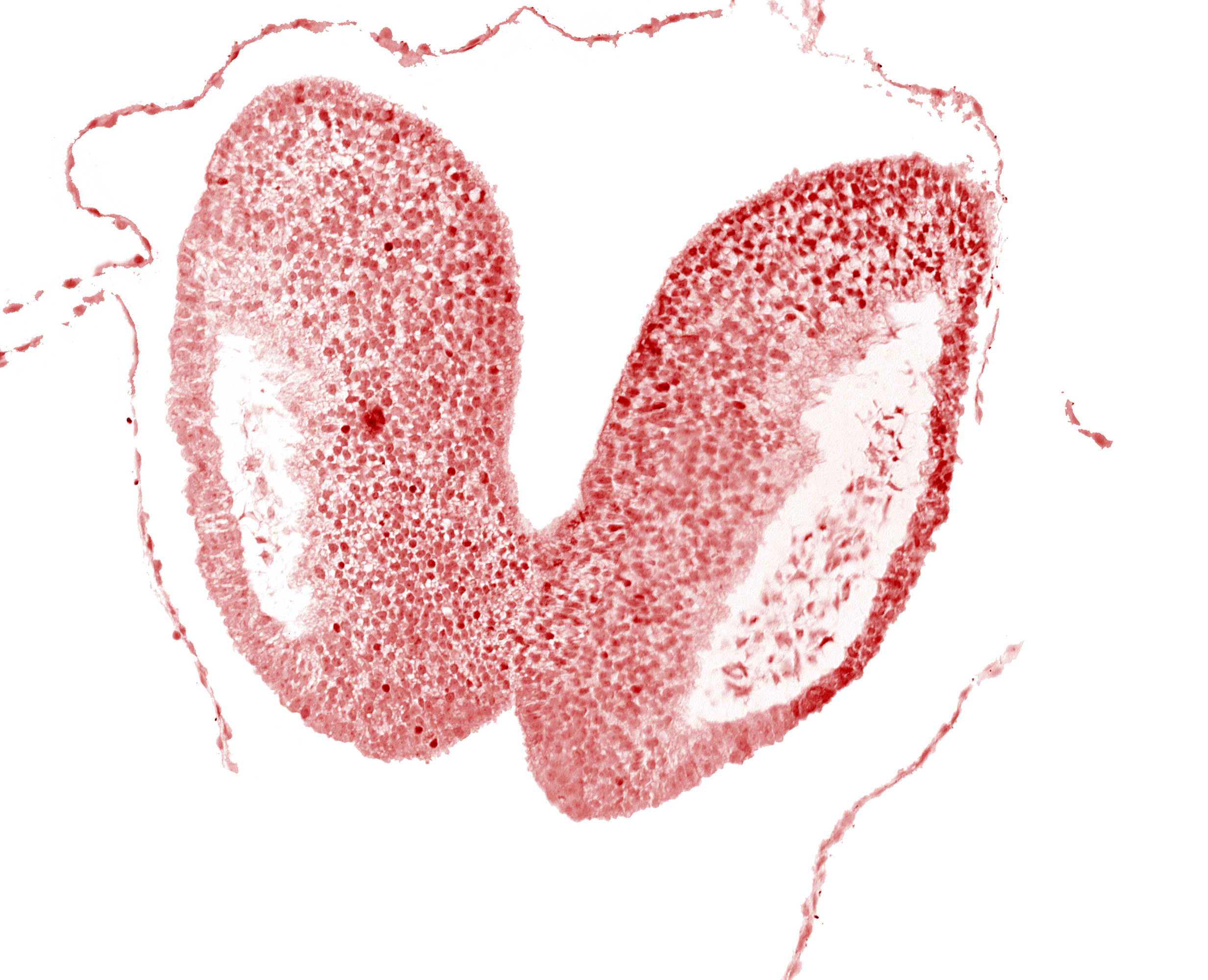 artifact space(s), cephalic neuropore, head mesenchyme, neural fold [primordial diencephalon (D1)], neural fold [primordial diencephalon (D2)], neural groove floor, optic sulcus [primordial diencephalon (D1)]