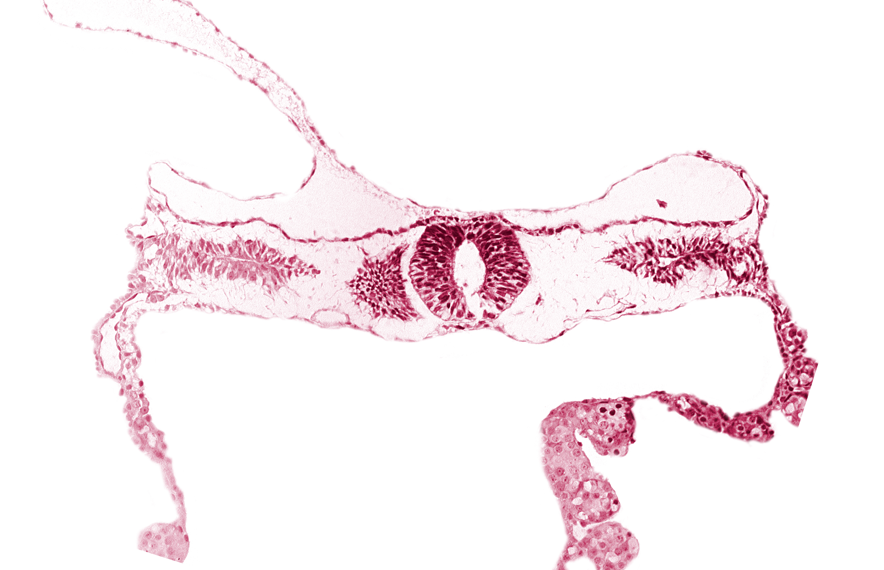 amnion attachment, amniotic cavity, extra-embryonic coelom, midgut, neural tube [rhombencephalon (Rh. D)], primordial peritoneal cavity, right umbilical vein, somite 3-4 intersegmental region, umbilical vesicle cavity, umbilical vesicle wall