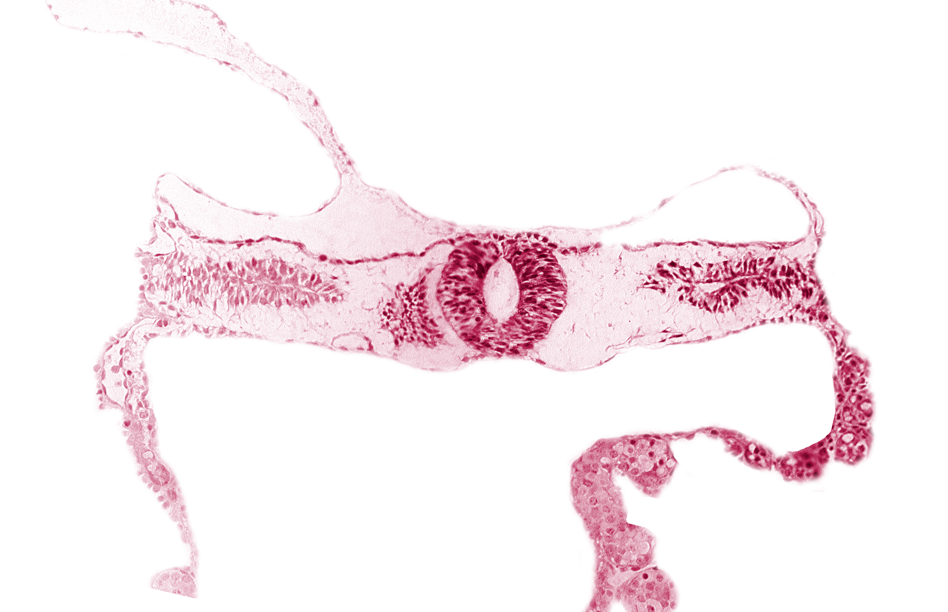 extra-embryonic coelom, midgut, neural tube [rhombencephalon (Rh. D)], somite 3-4 intersegmental region