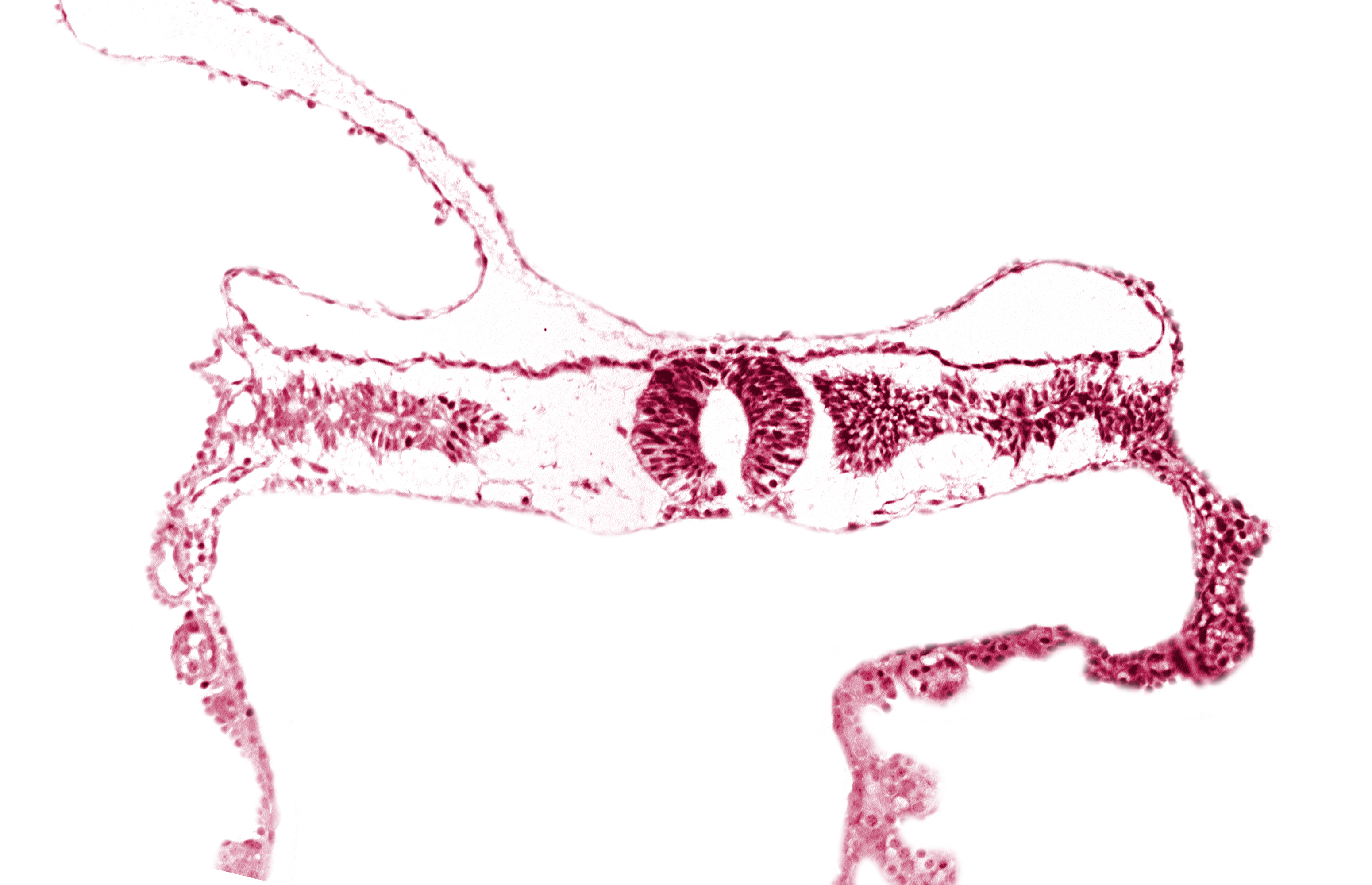 midgut, neural tube [rhombencephalon (Rh. D)], somite 3-4 intersegmental region