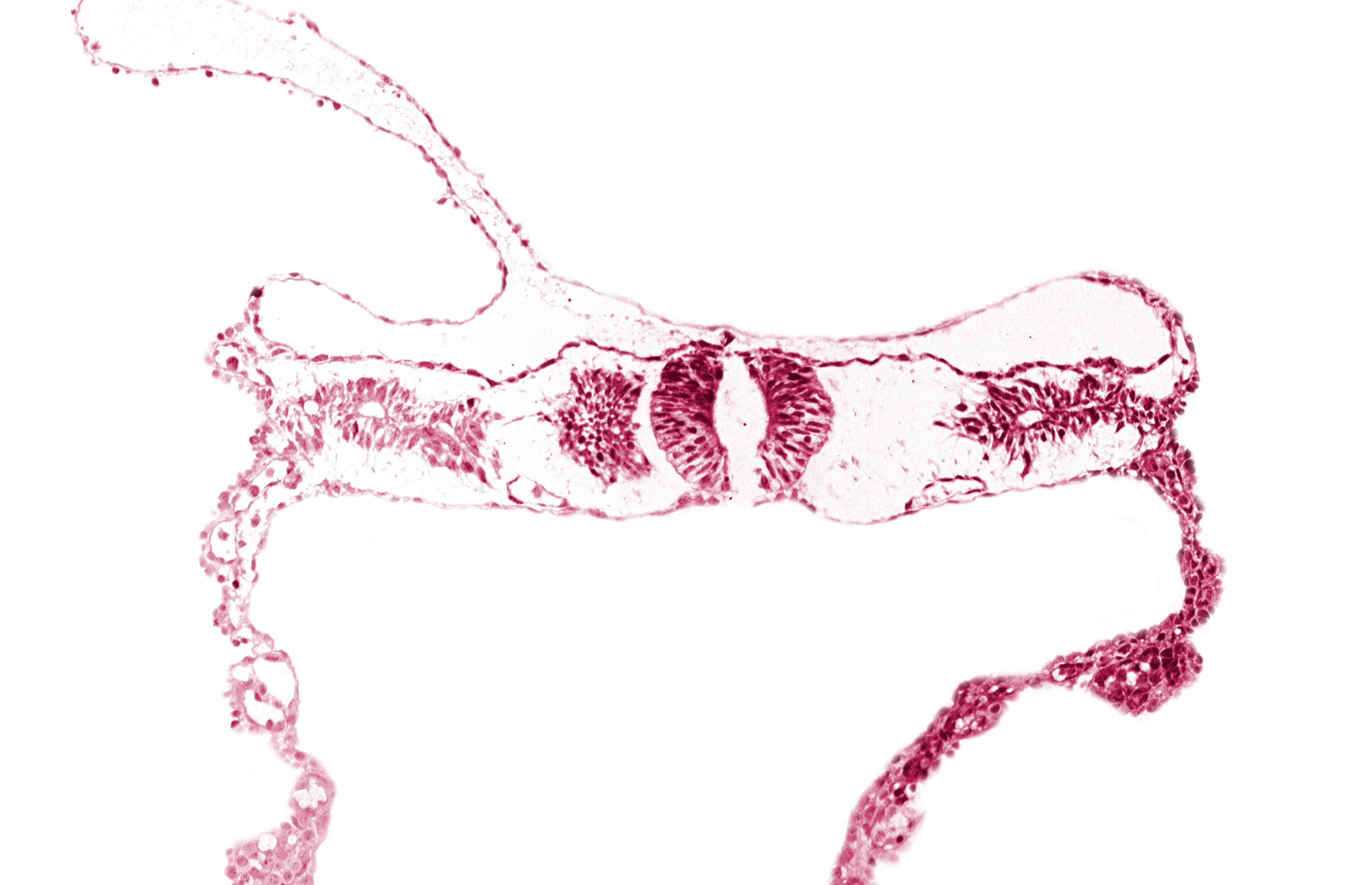 caudal edge of neural tube (junction of brain and spinal cord), fusing neural folds, primordial peritoneal cavity, right umbilical vein, somite 4-5 intersegmental region