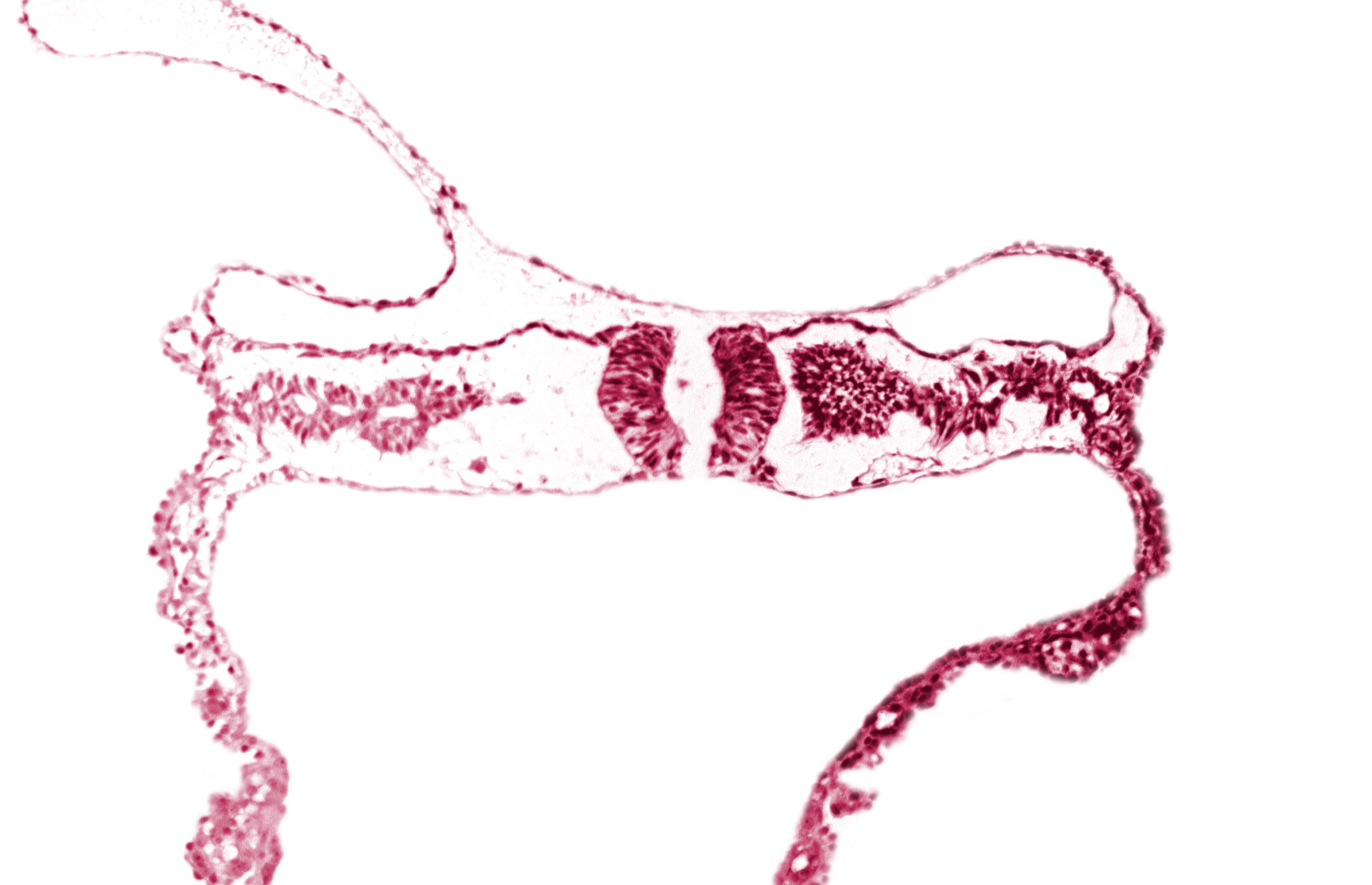 cephalic edge of caudal neuropore, cephalic part of somite 5 (C-1), dorsal aorta, midgut, neural fold (spinal cord), primordial peritoneal cavity