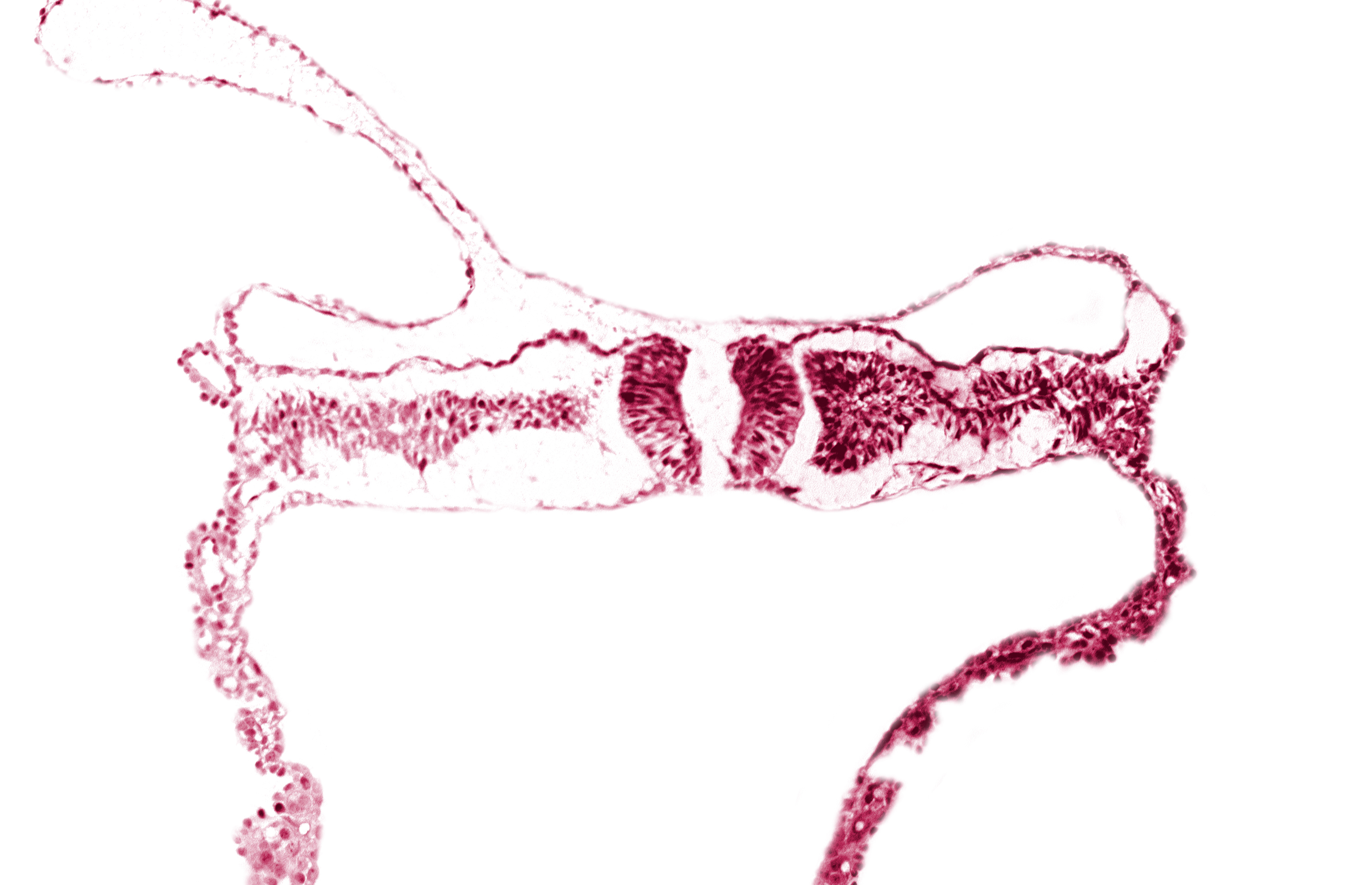 amniotic cavity, artifact separation(s), extra-embryonic coelom, intermediate mesenchyme, midgut, primordial peritoneal cavity, somite 5 (C-1), umbilical vesicle cavity