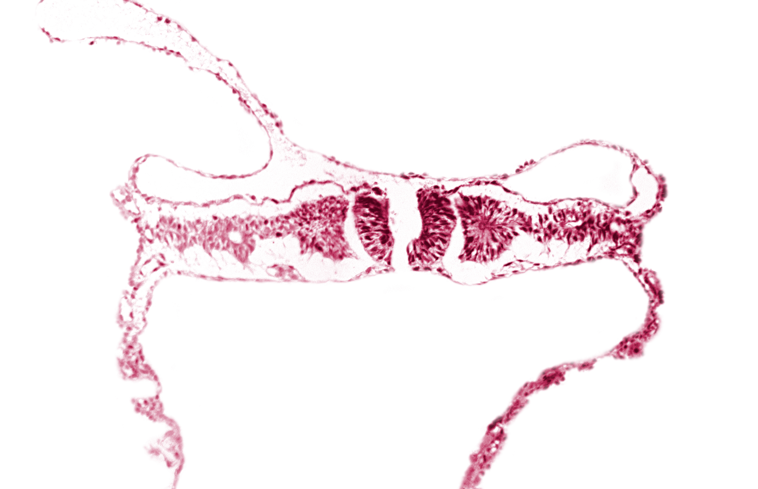 amniotic cavity, artifact separation(s), extra-embryonic coelom, intermediate mesenchyme, midgut, primordial peritoneal cavity, somite 5 (C-1), umbilical vesicle cavity