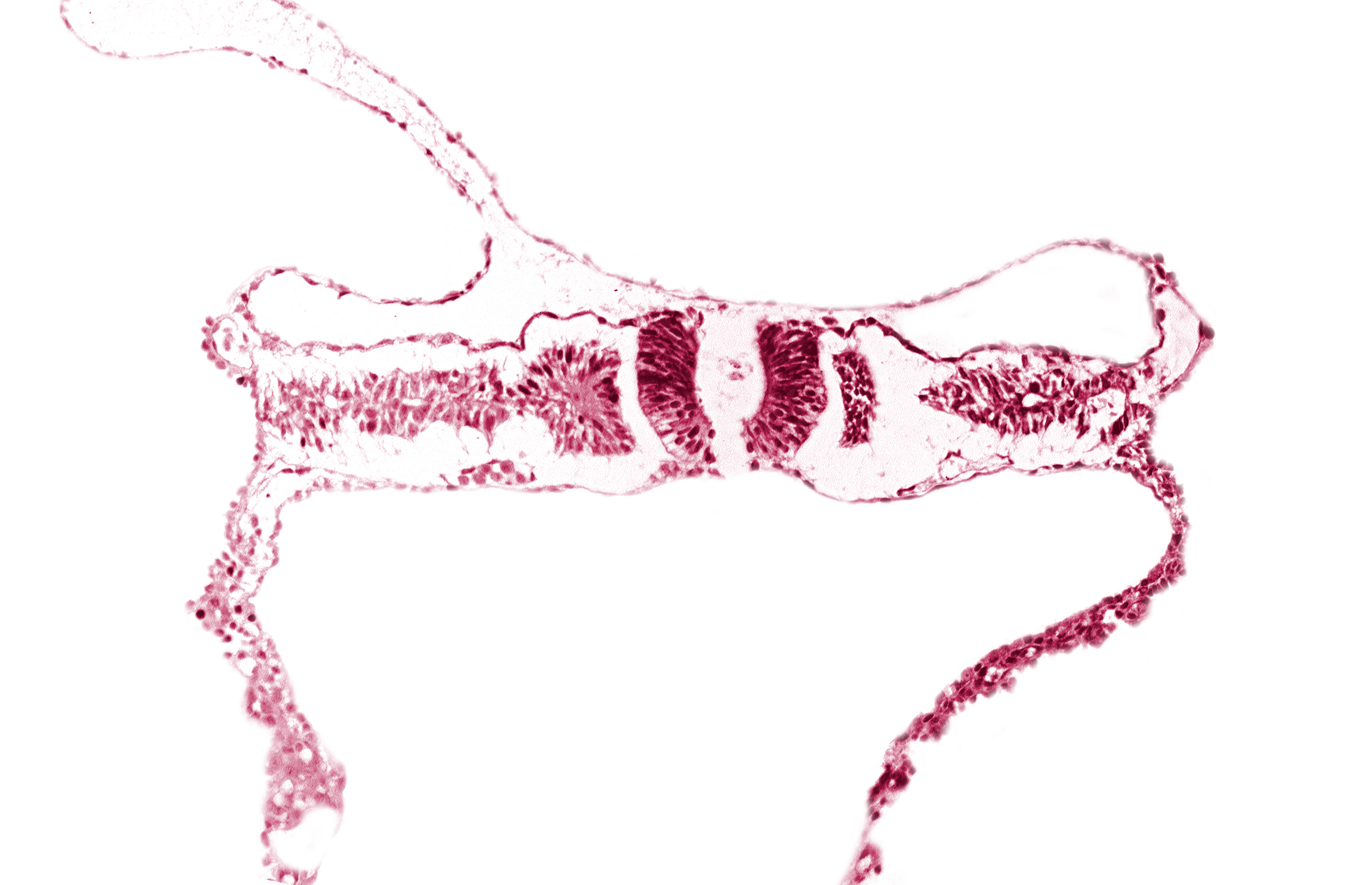 caudal edge of somite 5 (C-1), caudal neuropore, nephrogenic cord, umbilical vesicle wall