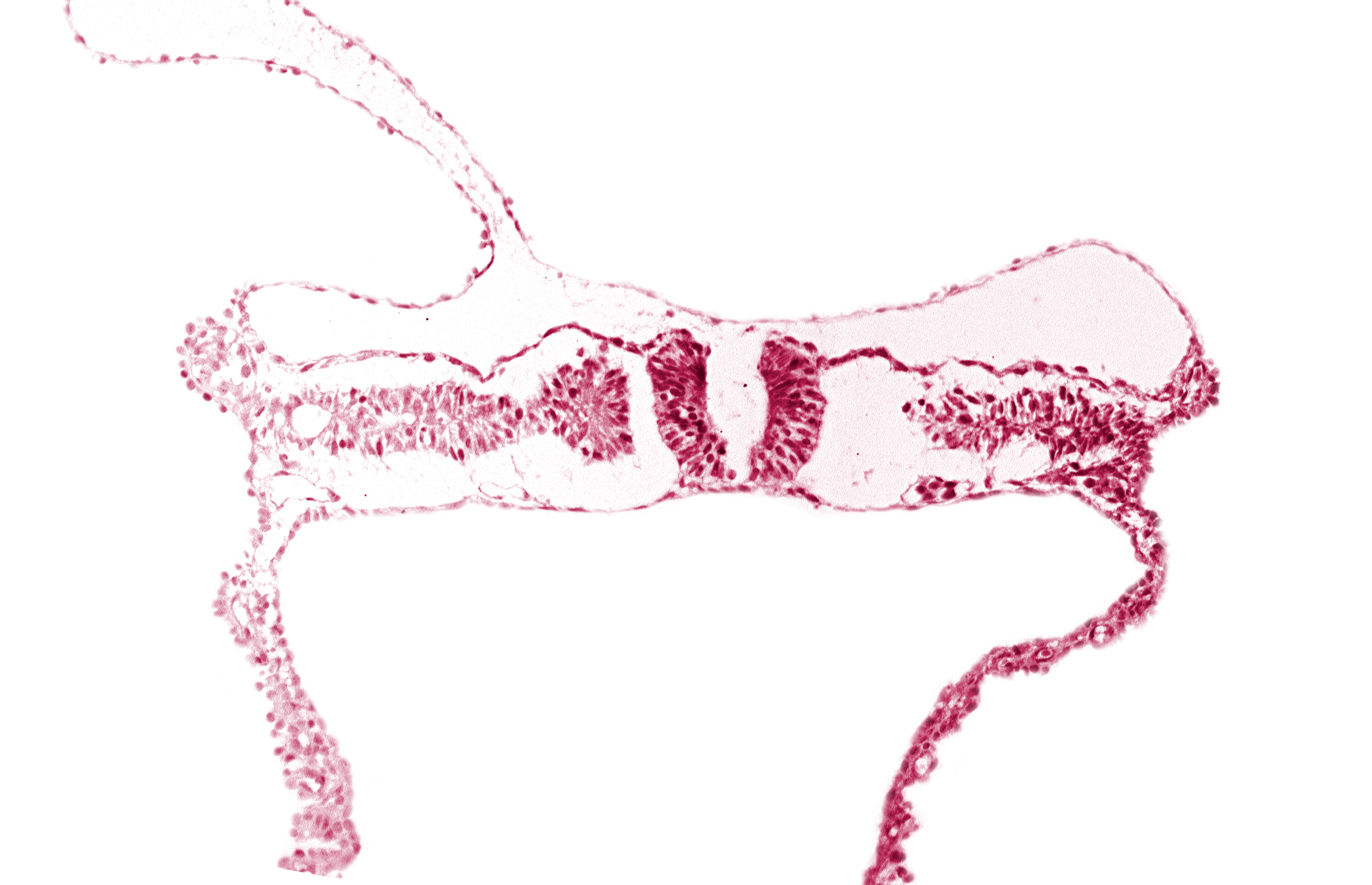embryonic endoderm, embryonic surface ectoderm, right umbilical vein, somite 6-7 intersegmental region, umbilical vesicle wall endoderm, umbilical vesicle wall mesoderm