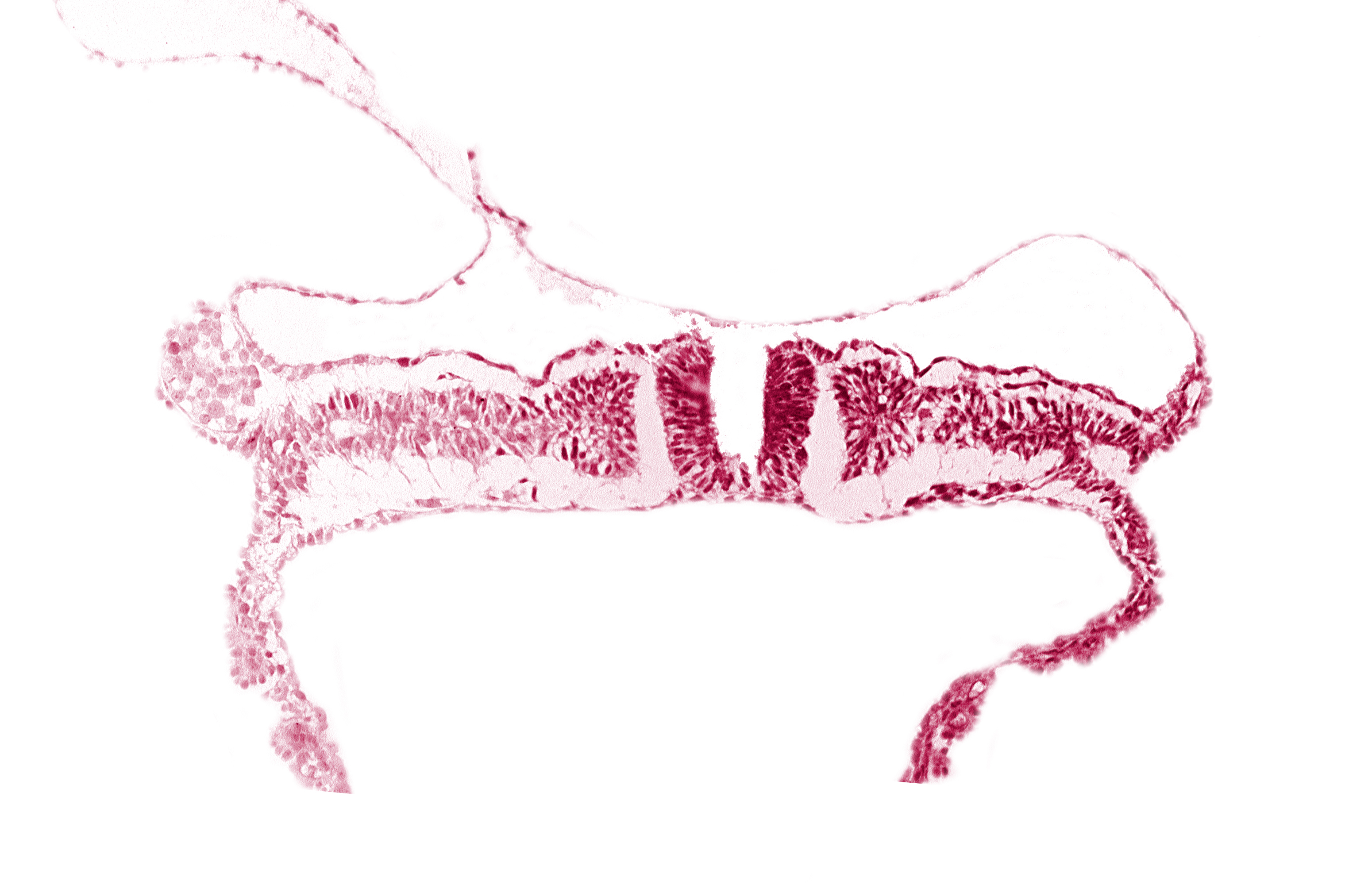caudal neuropore, communication between primordial peritoneal cavity and extra-embryonic coelom, dorsal aorta, extra-embryonic coelom, primordial peritoneal cavity, somite 7 (C-3), somitocoel 7