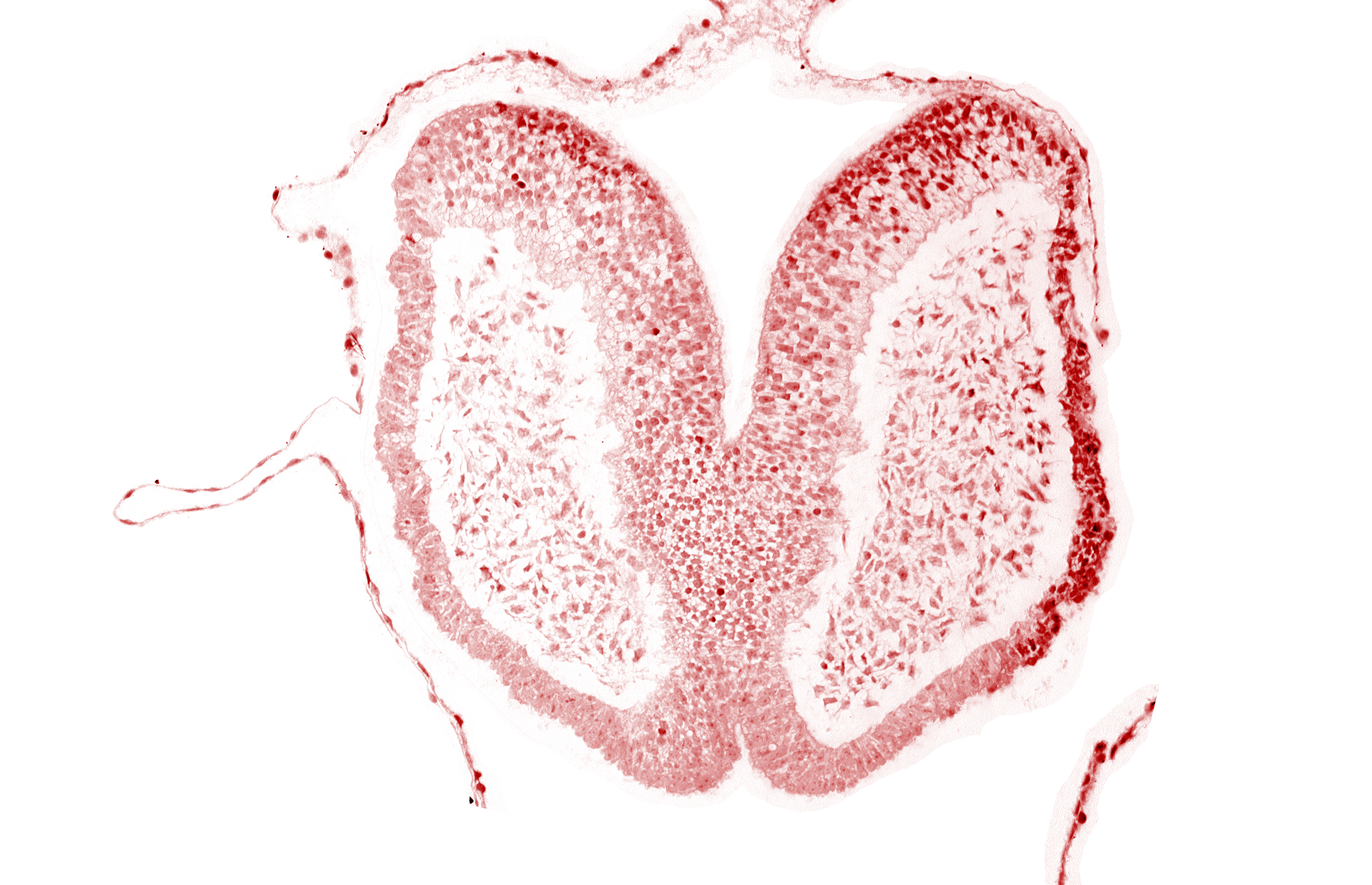 amniotic cavity, artifact space(s), chiasmatic plate (D1), head mesenchyme, junction of neural fold and surface ectoderm, maxillary prominence of pharyngeal arch 1, neural fold [primordial telencephalon medium (T)], surface ectoderm of head, terminal notch