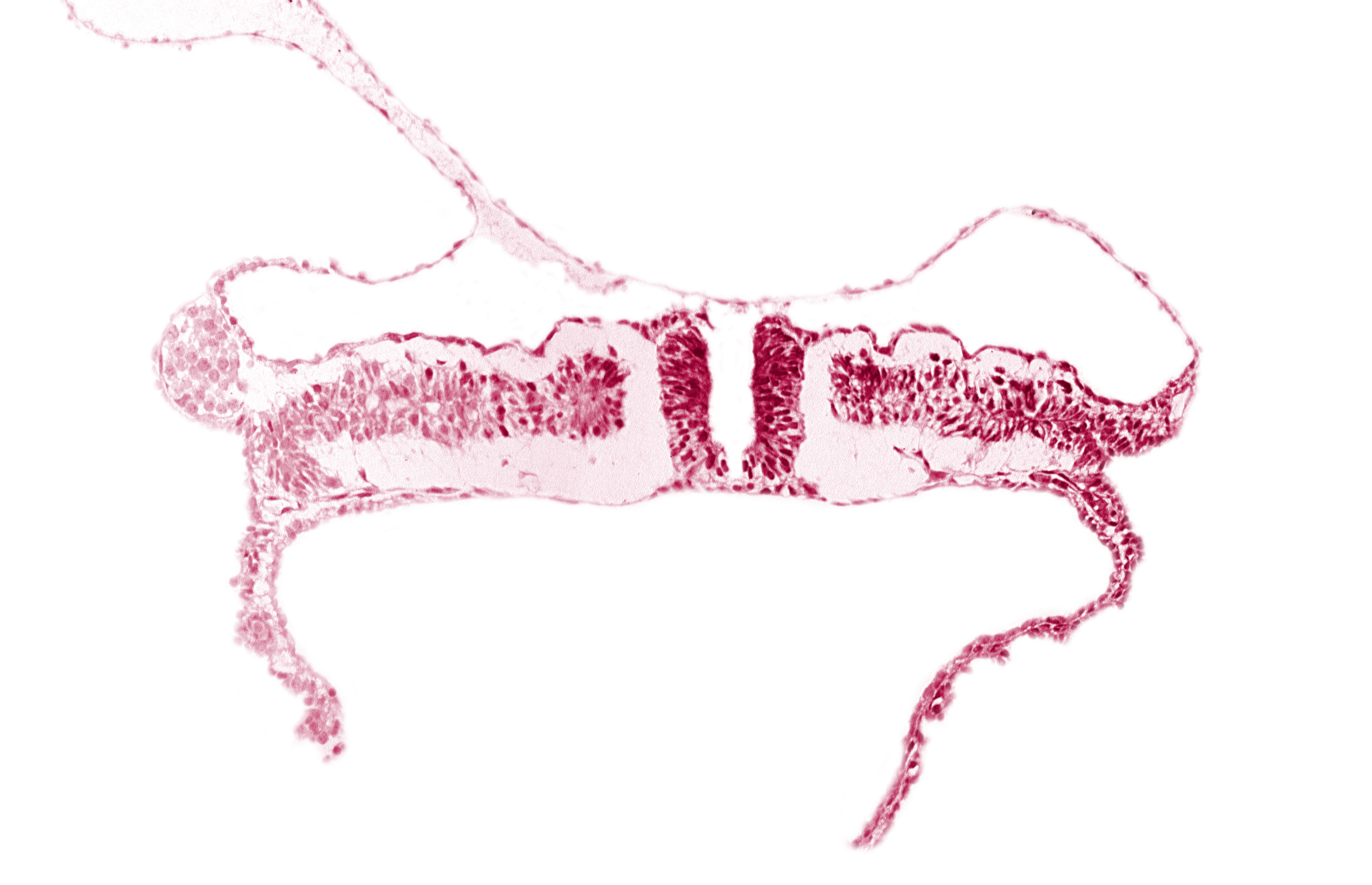 amnion attachment, amniotic cavity, caudal edge of somite 7 (C-3), caudal neuropore, endoderm, extra-embryonic coelom, extra-embryonic mesoderm, midgut, umbilical vesicle cavity, umbilical vesicle wall
